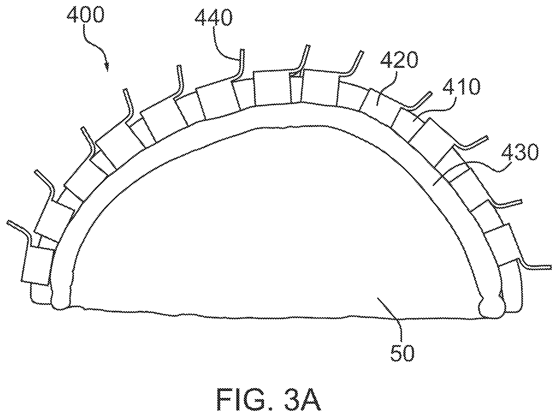 Patent US12318637 Figure 4 – Systems and methods for reducing thermal skull-induced aberrations during transcranial ultrasound therapeutic procedures