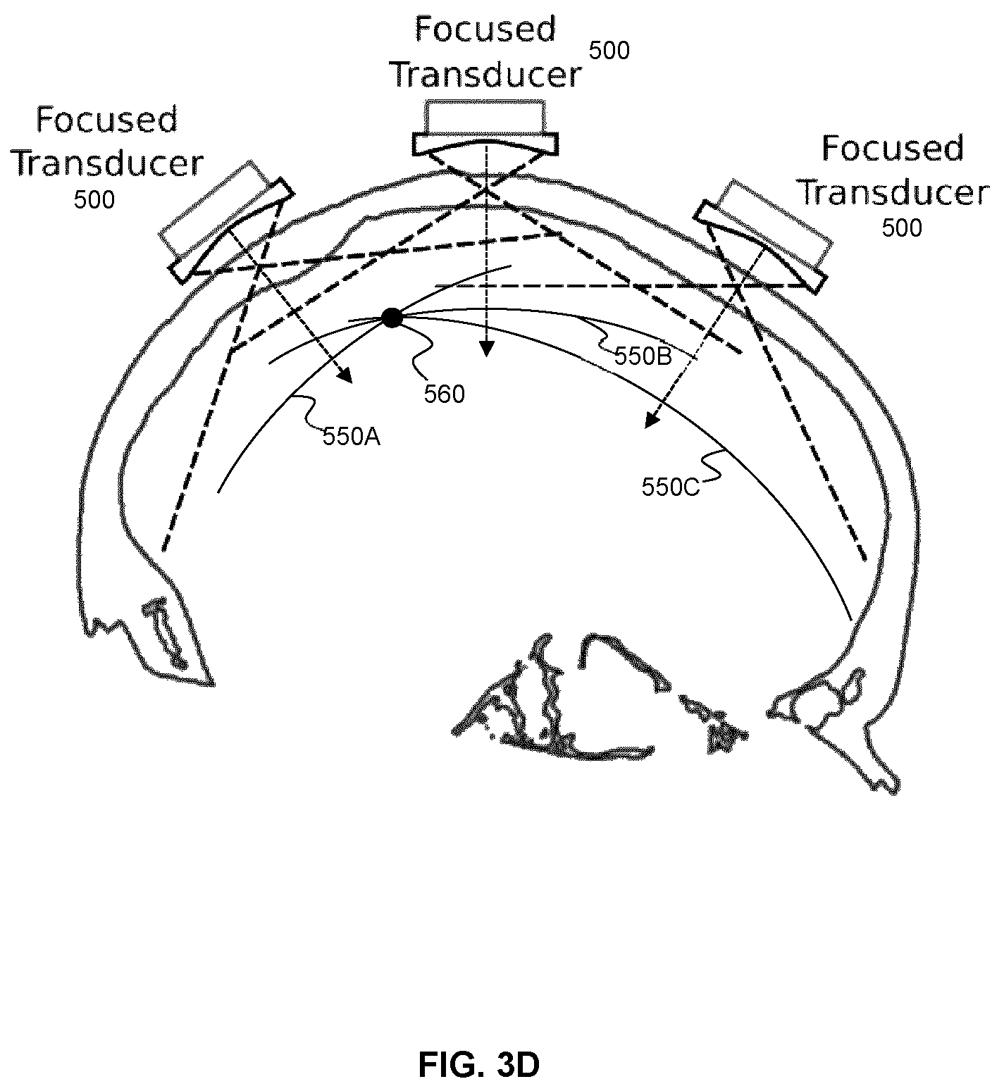 Patent US12318637 Figure 7 – Systems and methods for reducing thermal skull-induced aberrations during transcranial ultrasound therapeutic procedures