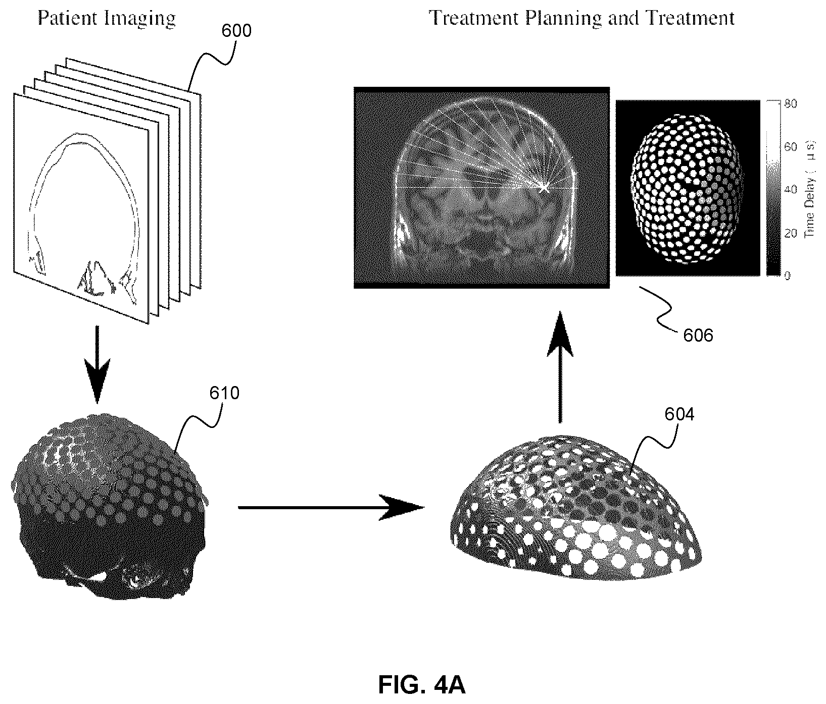 Patent US12318637 Figure 8 – Systems and methods for reducing thermal skull-induced aberrations during transcranial ultrasound therapeutic procedures