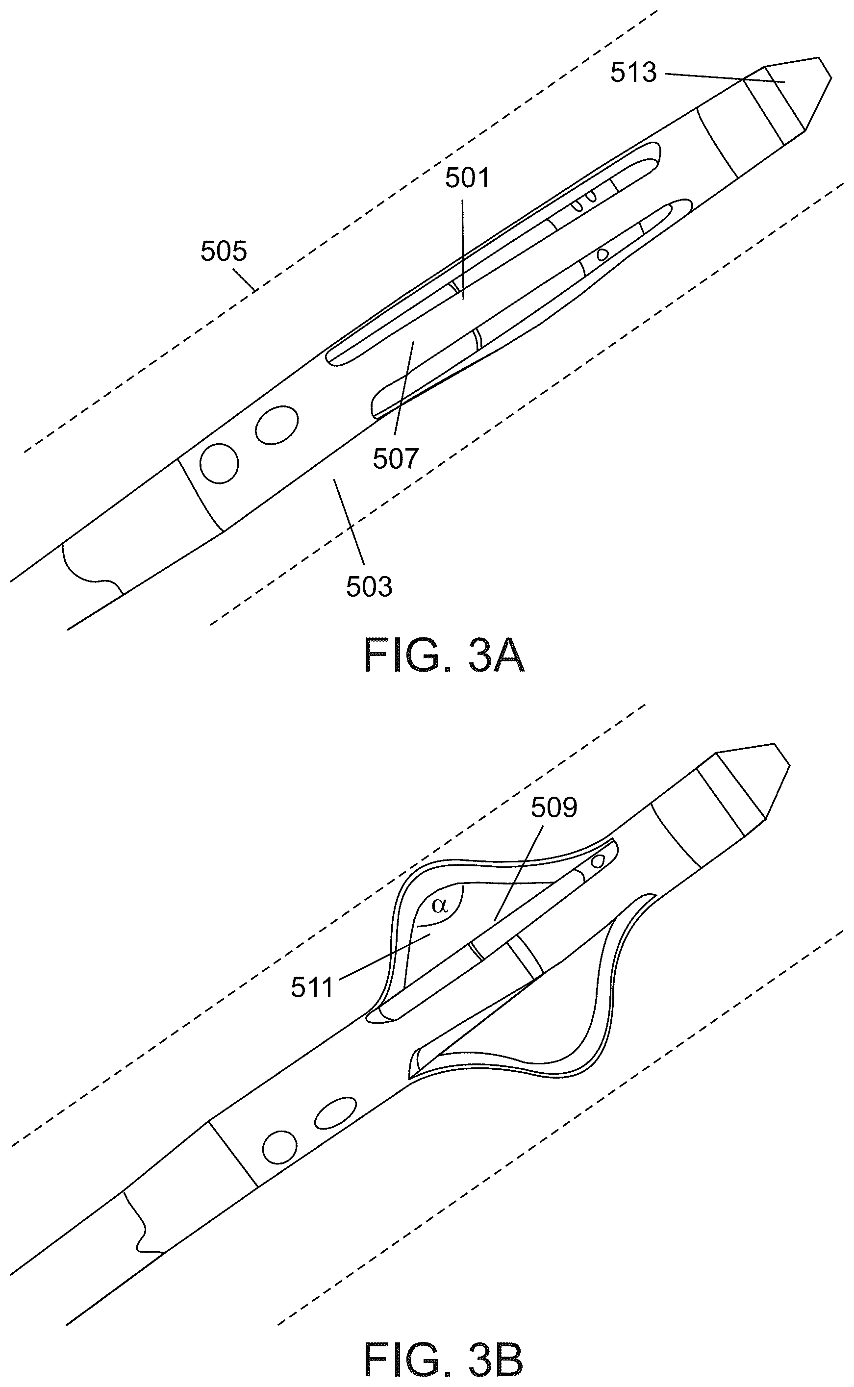 Patent US12318638 Figure 3 – Devices and methods for reducing parasympathetic nerve activity in patients with a respiratory syndrome