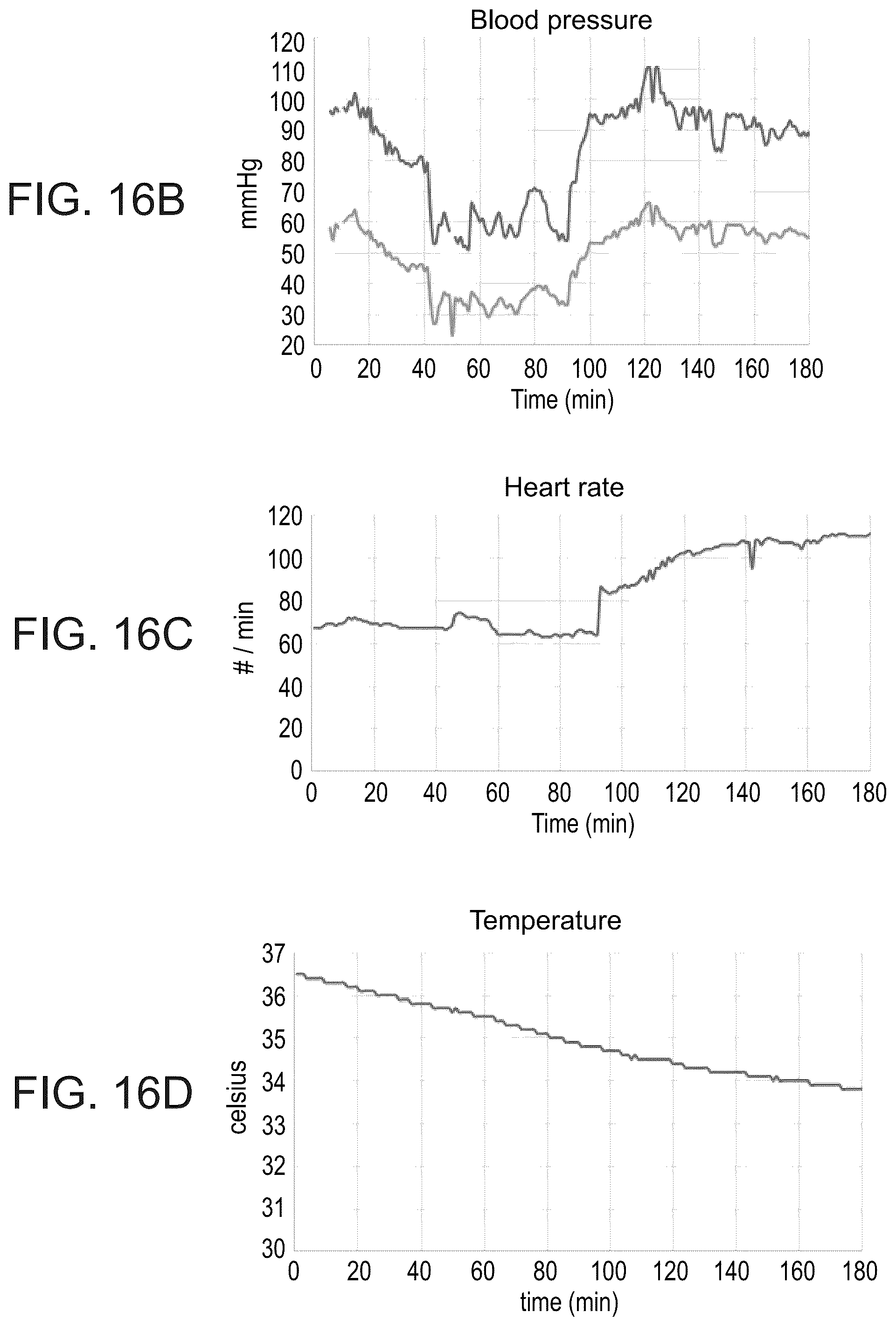 Patent US12318638 Figure 19 – Devices and methods for reducing parasympathetic nerve activity in patients with a respiratory syndrome