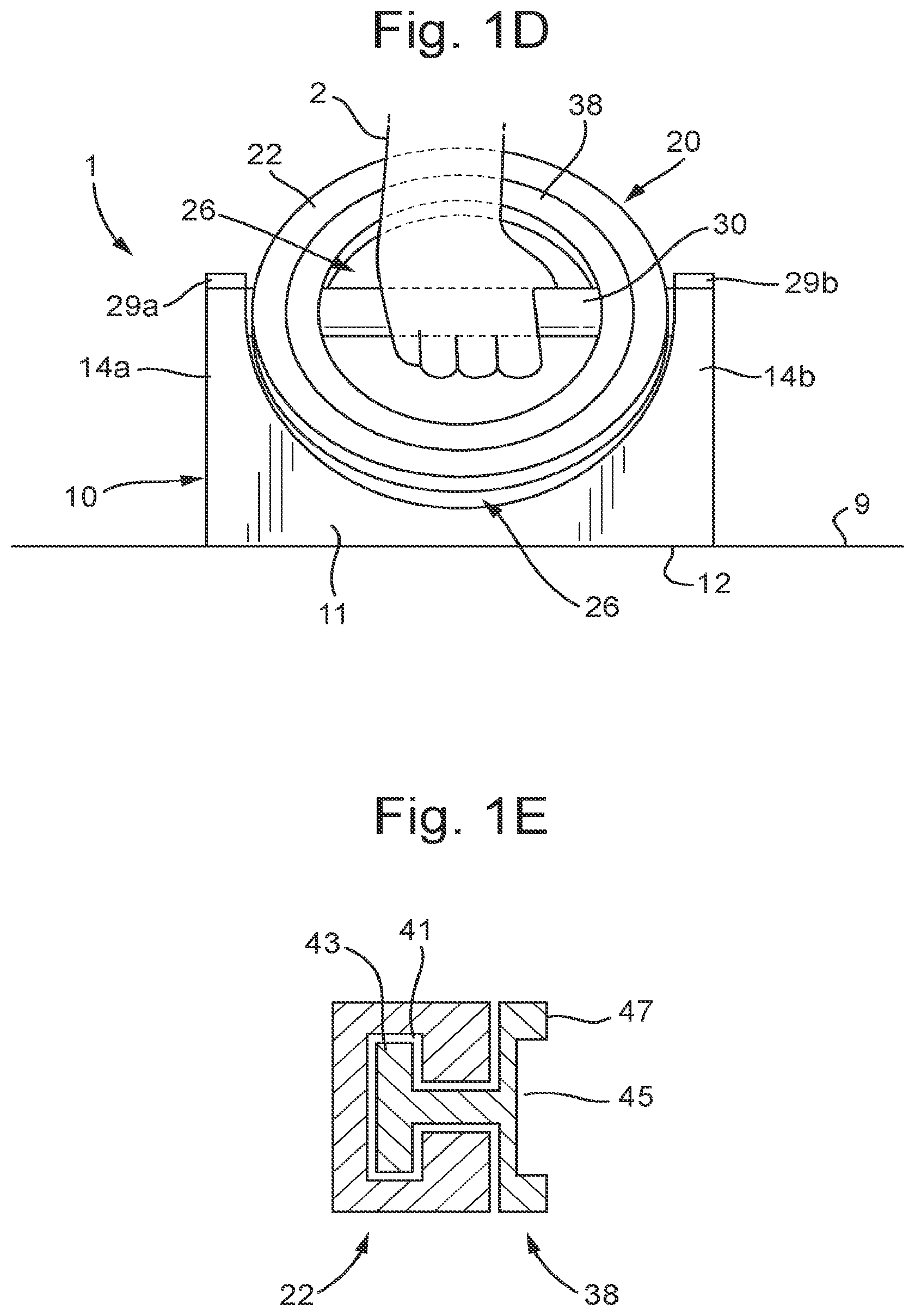Patent US12318653 Figure 3 – Dynamic exercise device