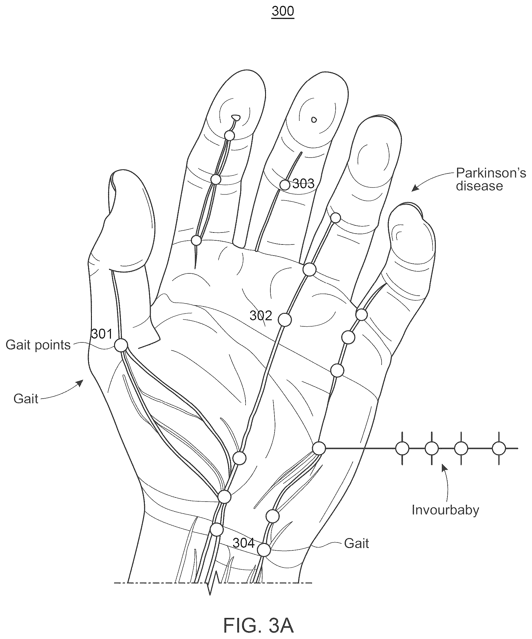 Patent US12318663 Figure 3 – System and method for automated diagnosis of musculoskeletal and neurological disorders