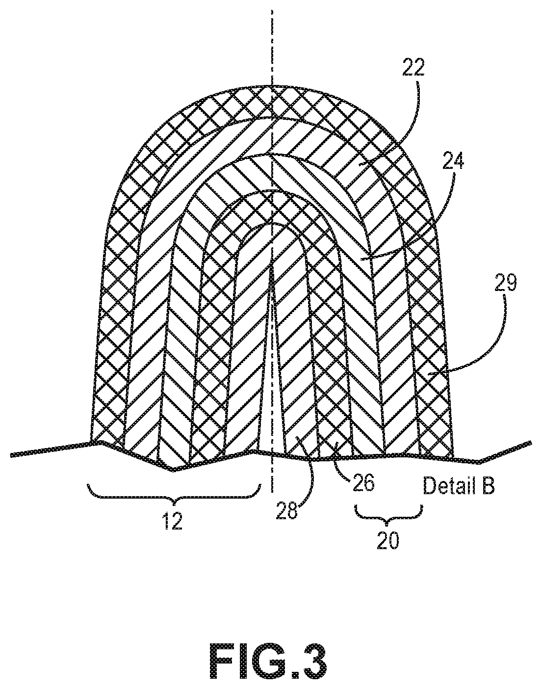 Patent US12318713 Figure 3 – Pleated fluid filter element and methods