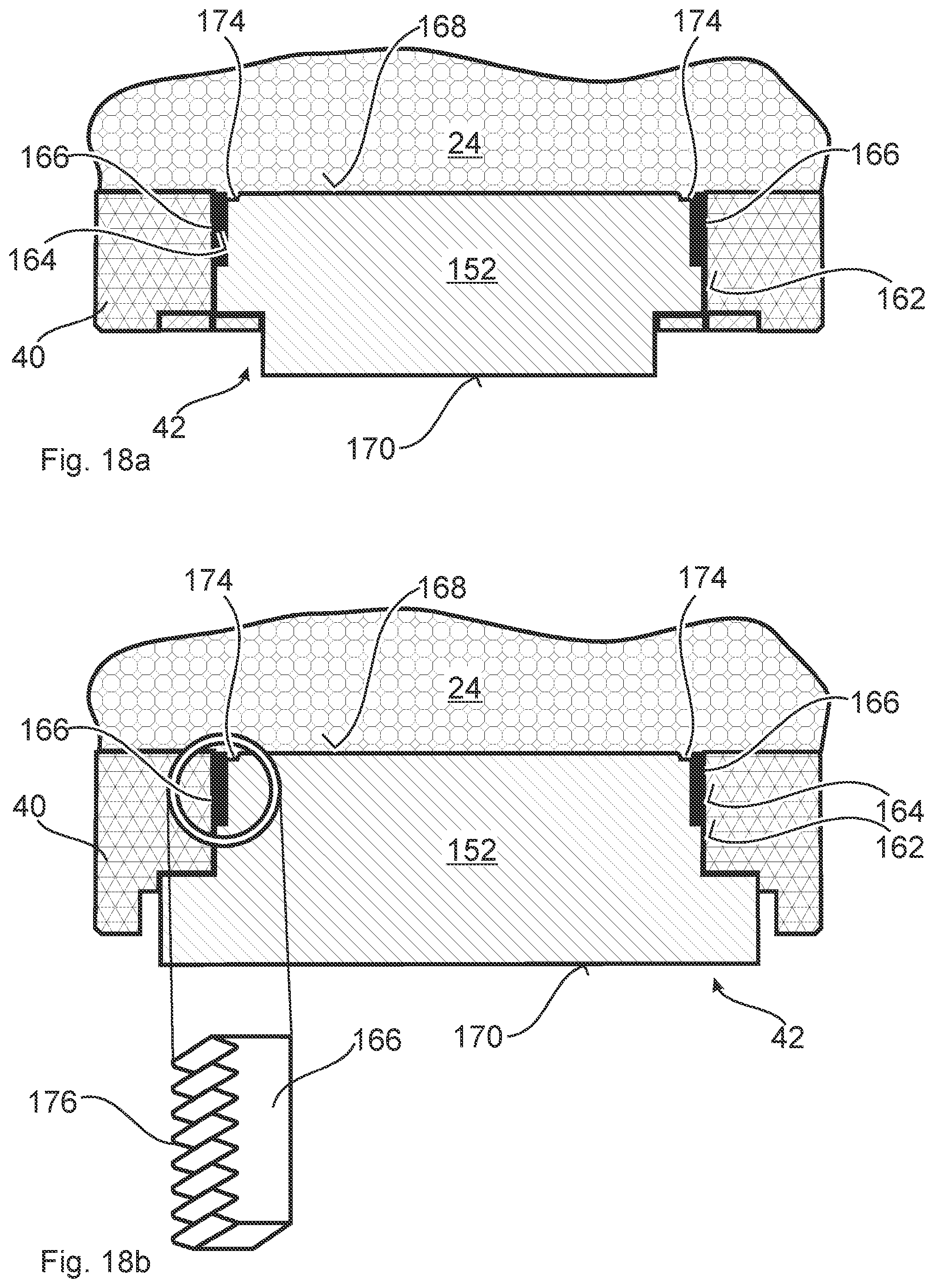 Patent US12318858 Figure 11 – Diffusion soldering and/or sintering device, die and system, for connecting components of at least one electronic assembly