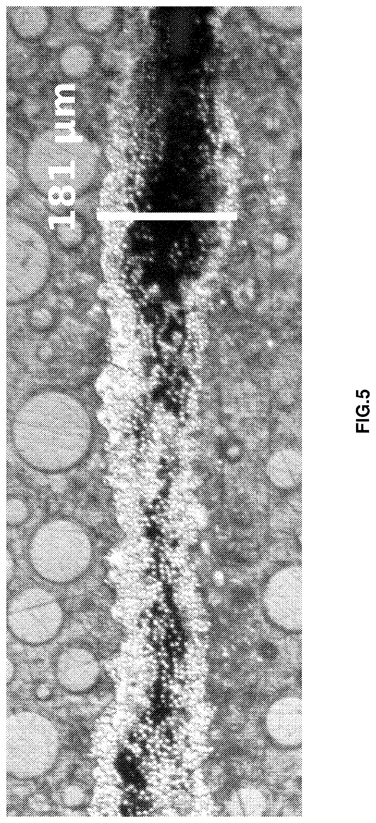 Patent US12319018 Figure 5 – Fibrous material impregnated with thermoplastic polymer having a thickness of less than or equal to 100MM and method for the production thereof