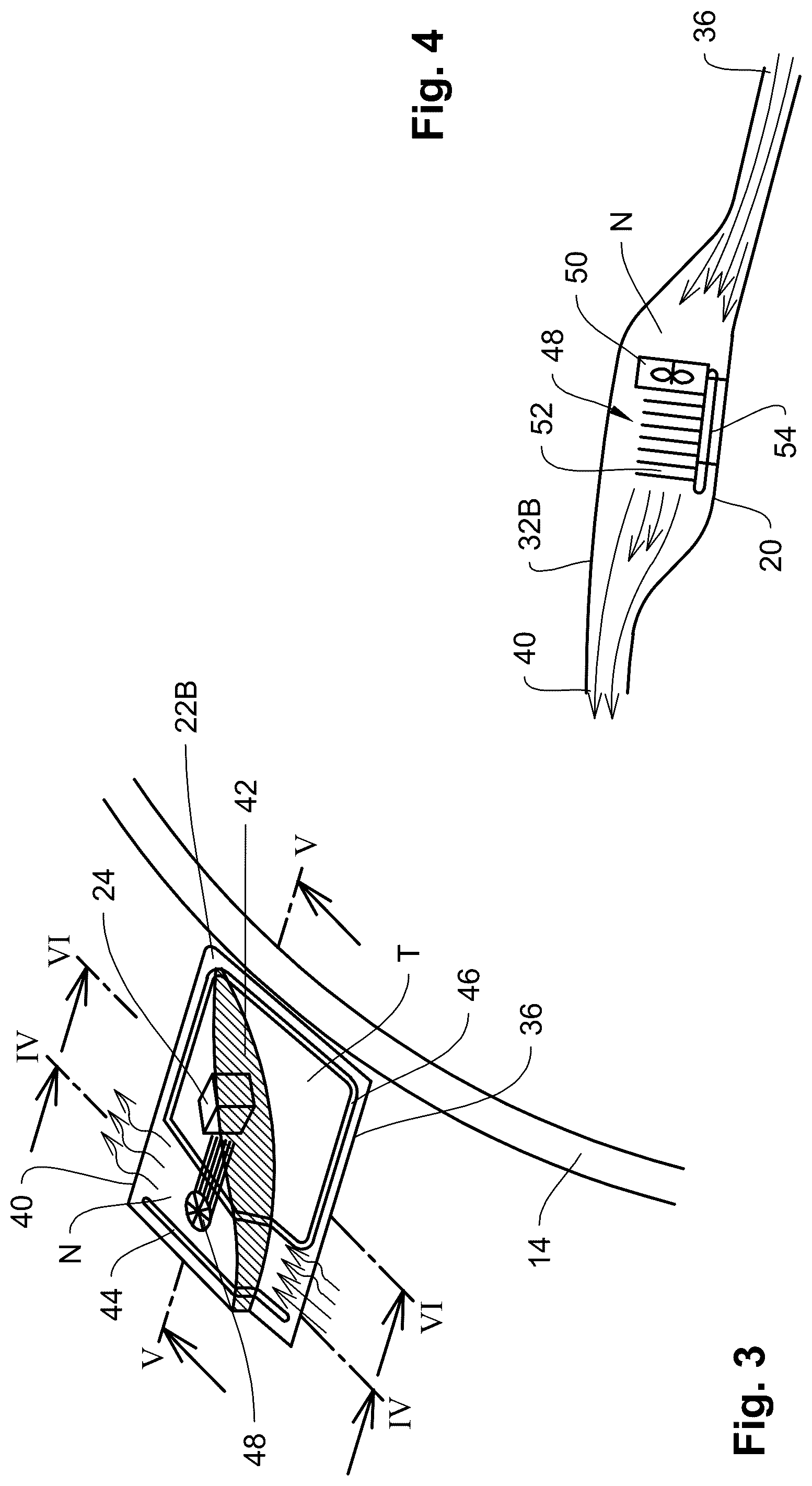 Patent US12319349 Figure 3 – Vehicle roof with sensor module and trim element