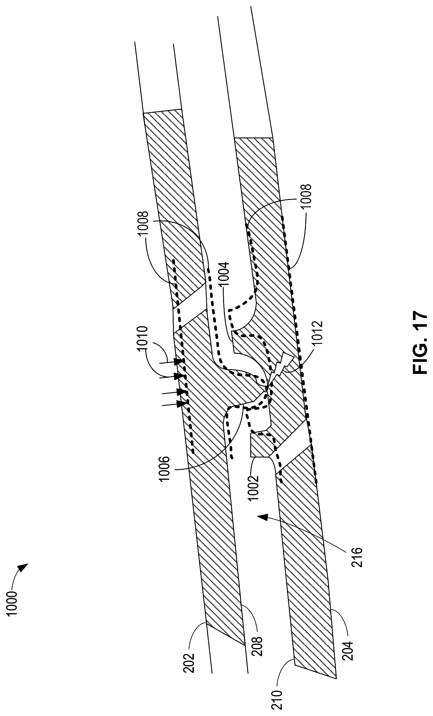 Patent US12319417 Figure 16 – Reverse flow gas turbine engine having electric machine