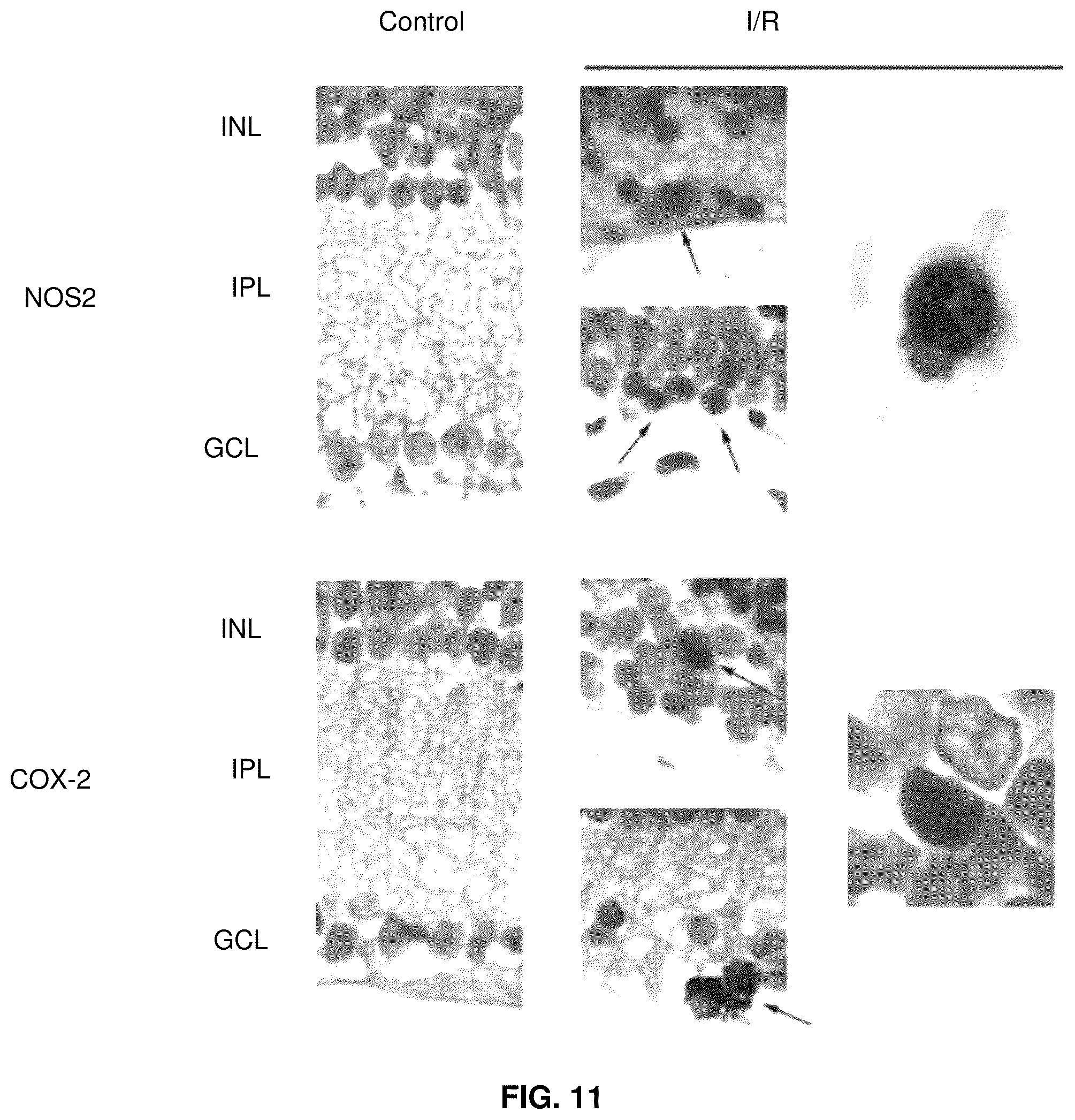 Patent US12319726 Figure 11 – Method for treating CD40-mediated diseases