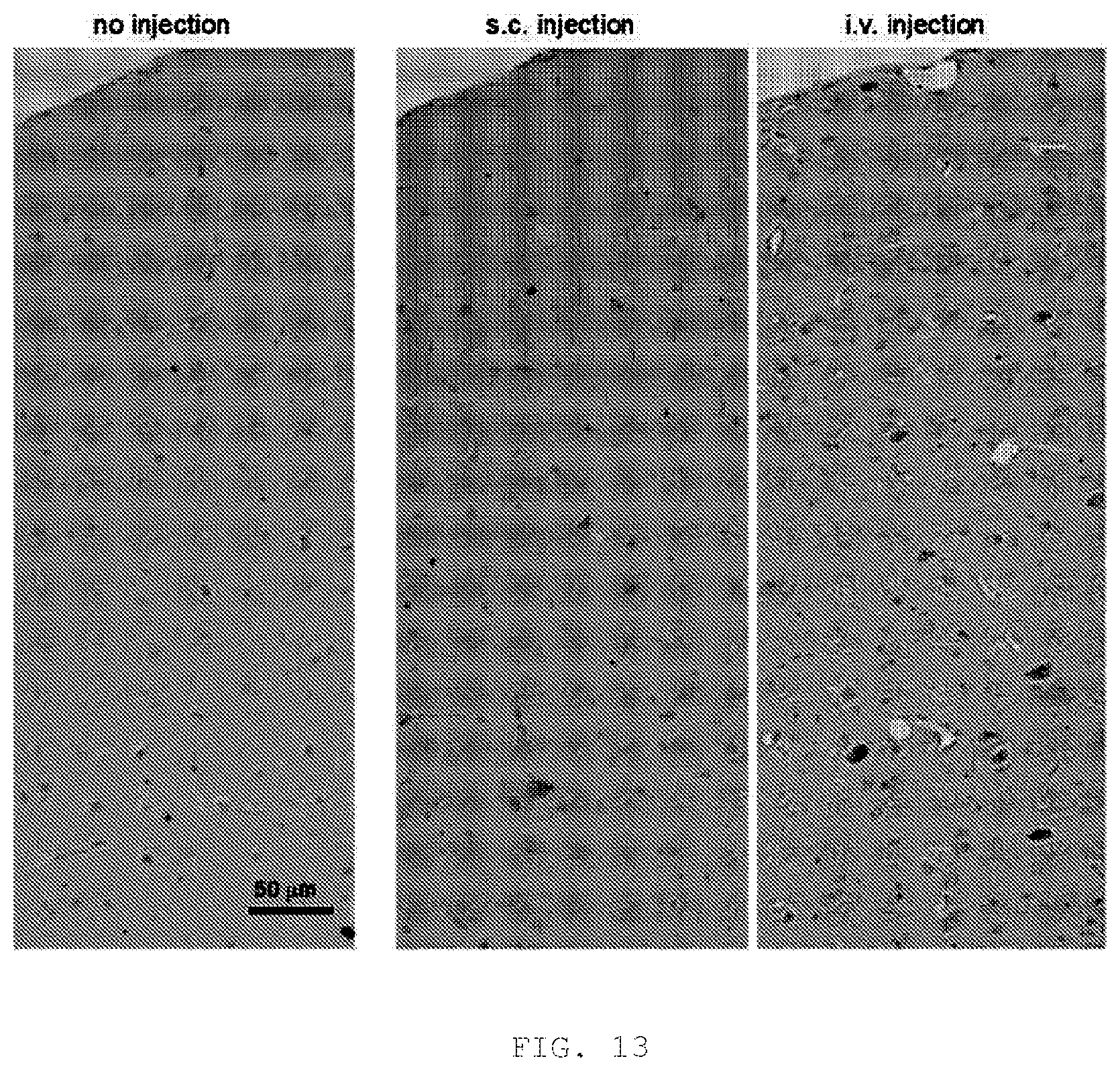 Patent US12319731 Figure 8 – Human monoclonal antibody binding specifically to human HMGB1, and pharmaceutical composition for treating or preventing Alzheimer's disease containing said human monoclonal antibody