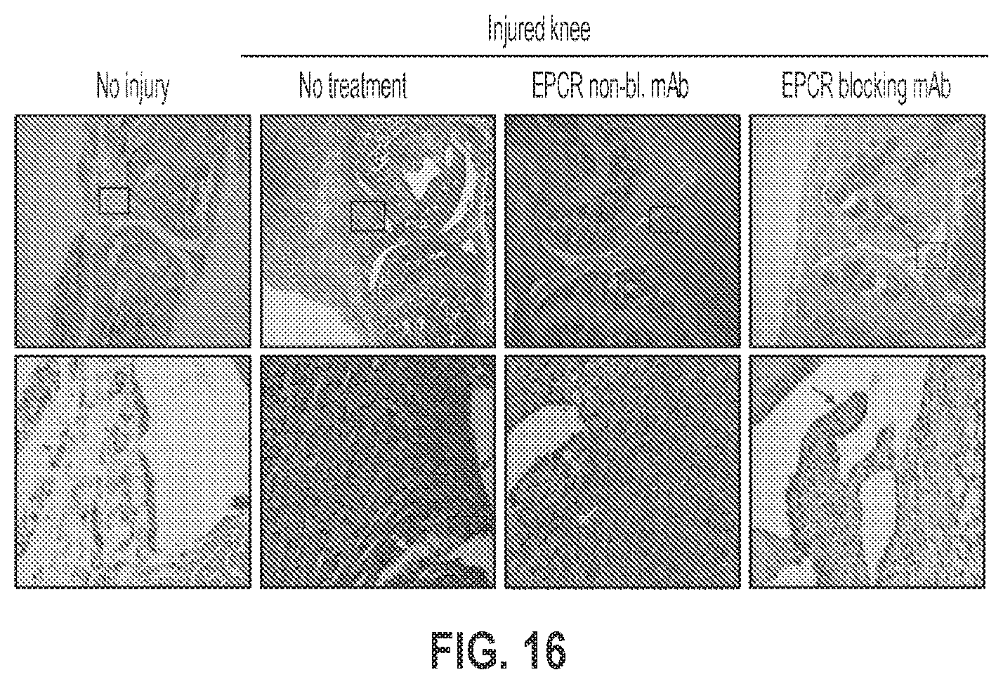 Patent US12319744 Figure 16 – Treatment and prevention of hemophilic arthropathy with an antibody against endothelial cell protein C receptor (EPCR)