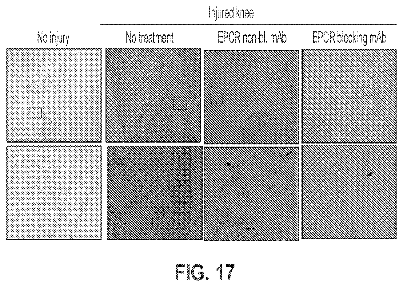 Patent US12319744 Figure 17 – Treatment and prevention of hemophilic arthropathy with an antibody against endothelial cell protein C receptor (EPCR)