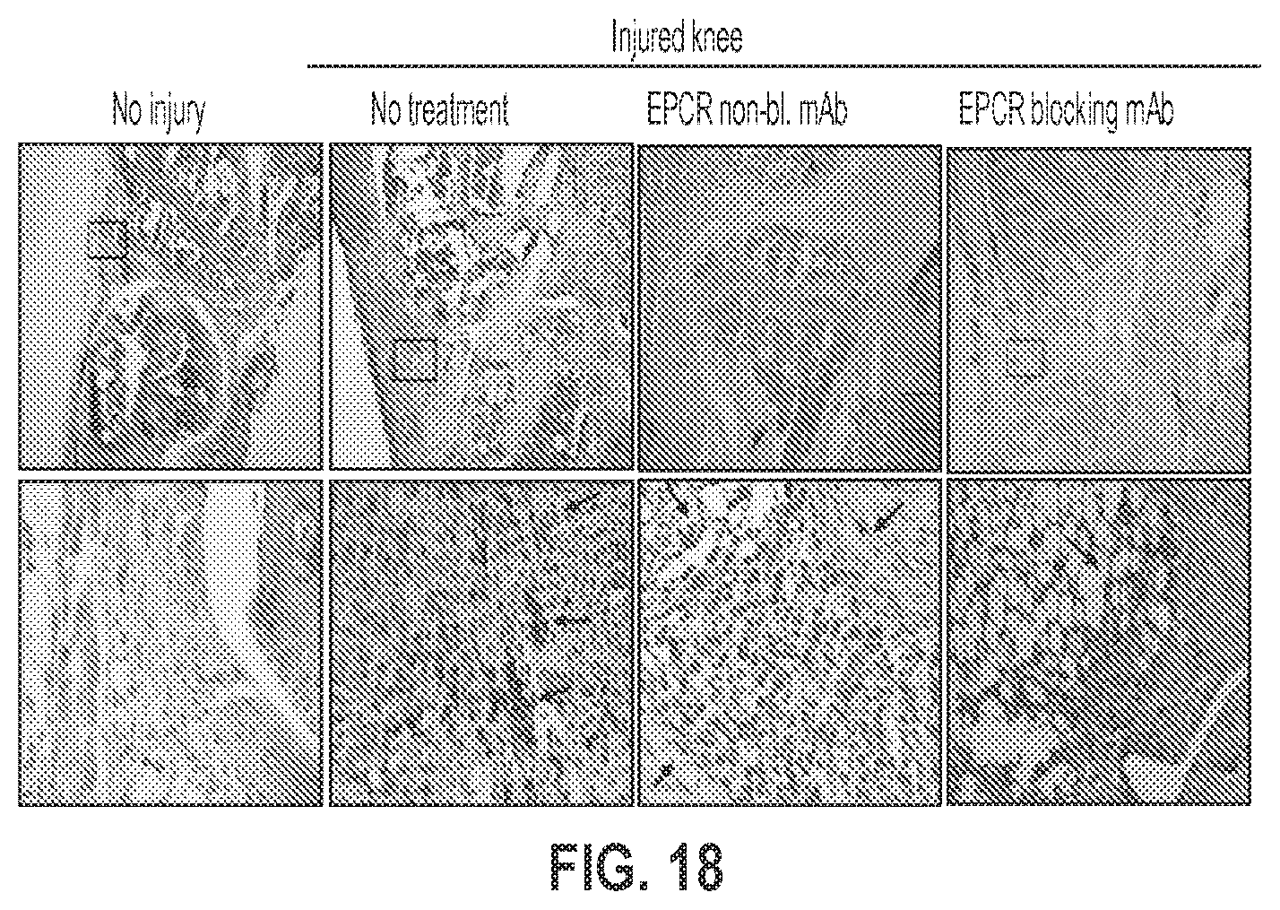 Patent US12319744 Figure 18 – Treatment and prevention of hemophilic arthropathy with an antibody against endothelial cell protein C receptor (EPCR)