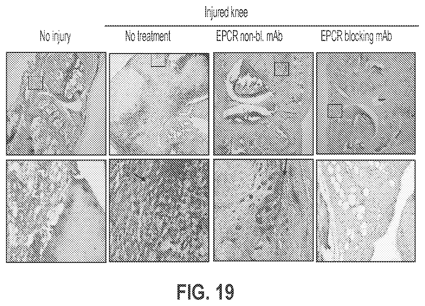 Patent US12319744 Figure 19 – Treatment and prevention of hemophilic arthropathy with an antibody against endothelial cell protein C receptor (EPCR)