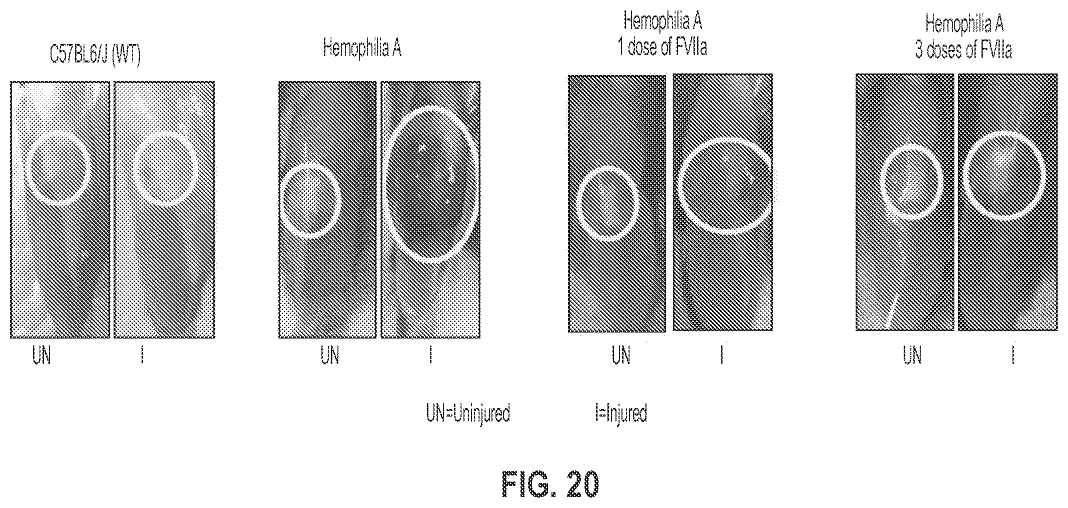 Patent US12319744 Figure 20 – Treatment and prevention of hemophilic arthropathy with an antibody against endothelial cell protein C receptor (EPCR)