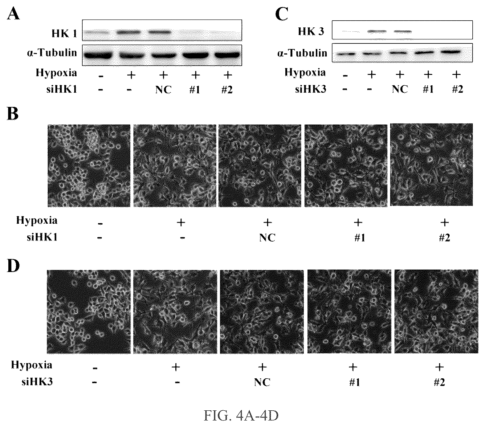 Patent US12319750 Figure 4 – Hexokinase 2-specific inhibitors for use in acute central nervous system injury