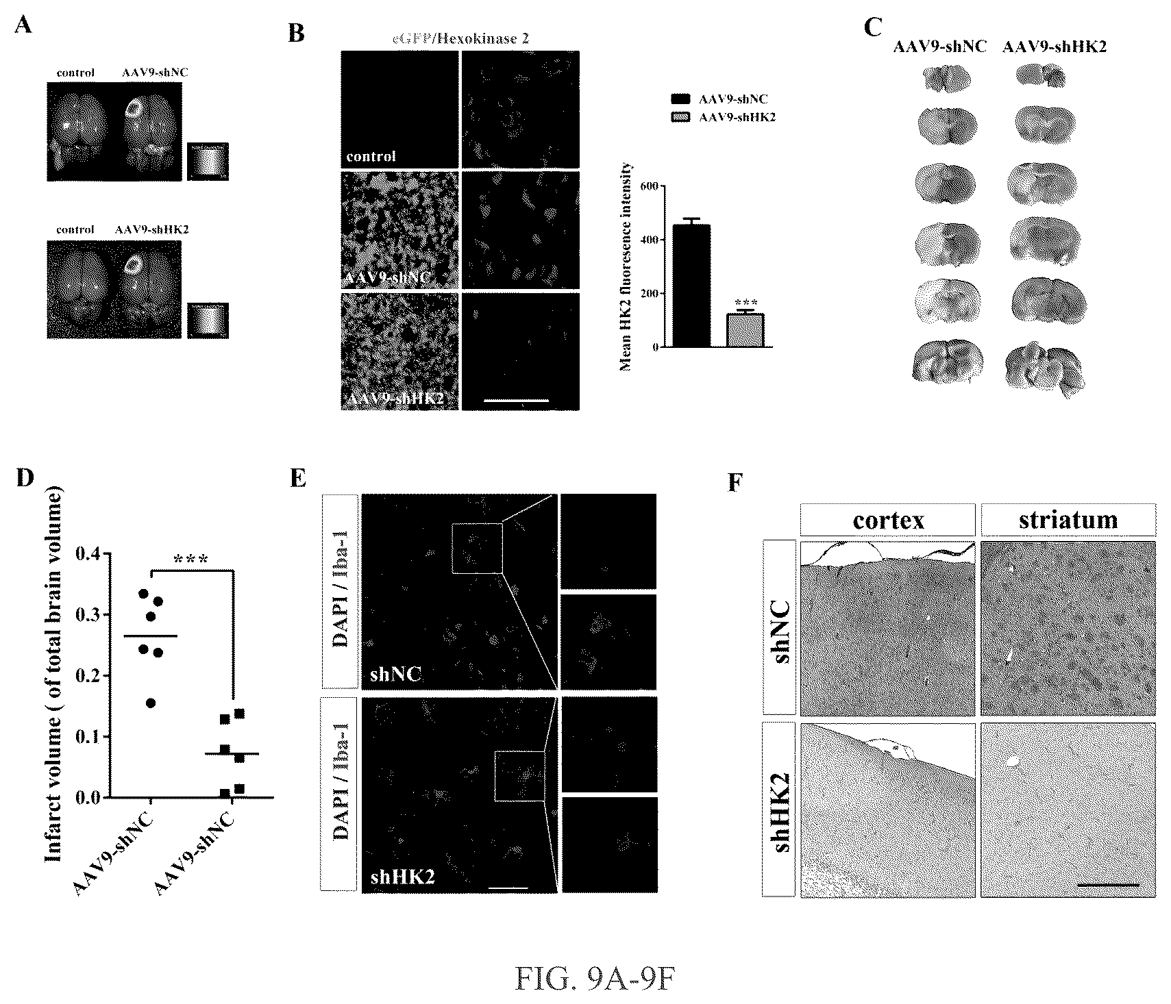 Patent US12319750 Figure 9 – Hexokinase 2-specific inhibitors for use in acute central nervous system injury