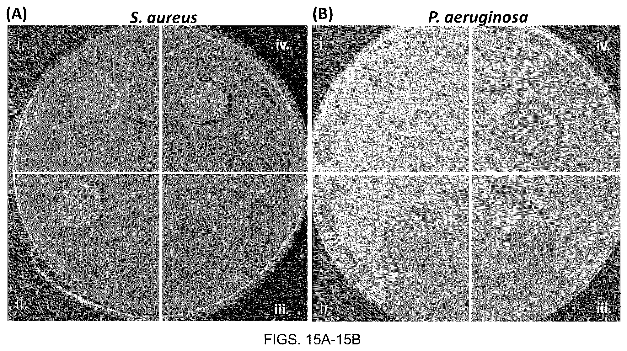 Patent US12319828 Figure 16 – Surfaces and coating compositions having antifouling, antithrombotic, and antibacterial properties and methods of making