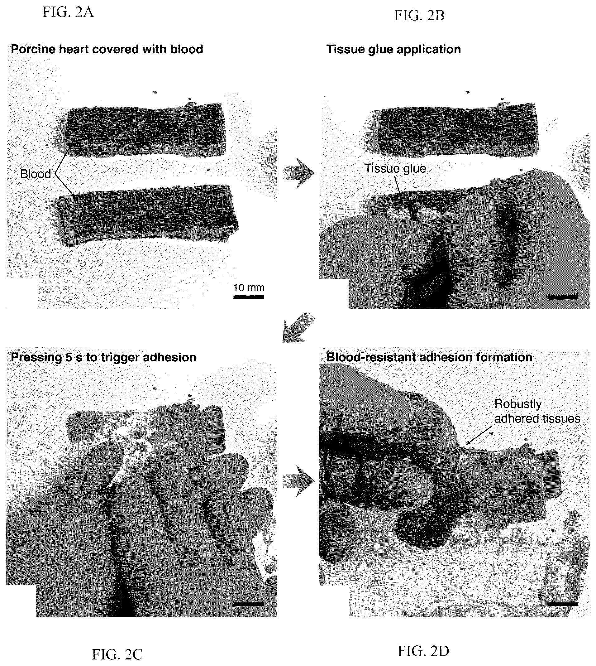 Patent US12319844 Figure 2 – Body fluid resistant tissue adhesives