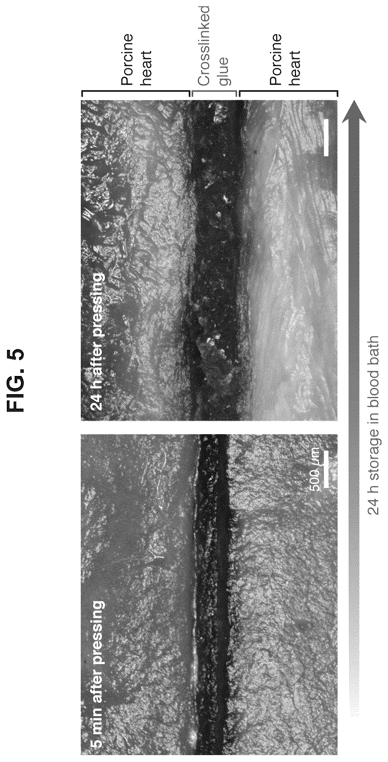 Patent US12319844 Figure 5 – Body fluid resistant tissue adhesives