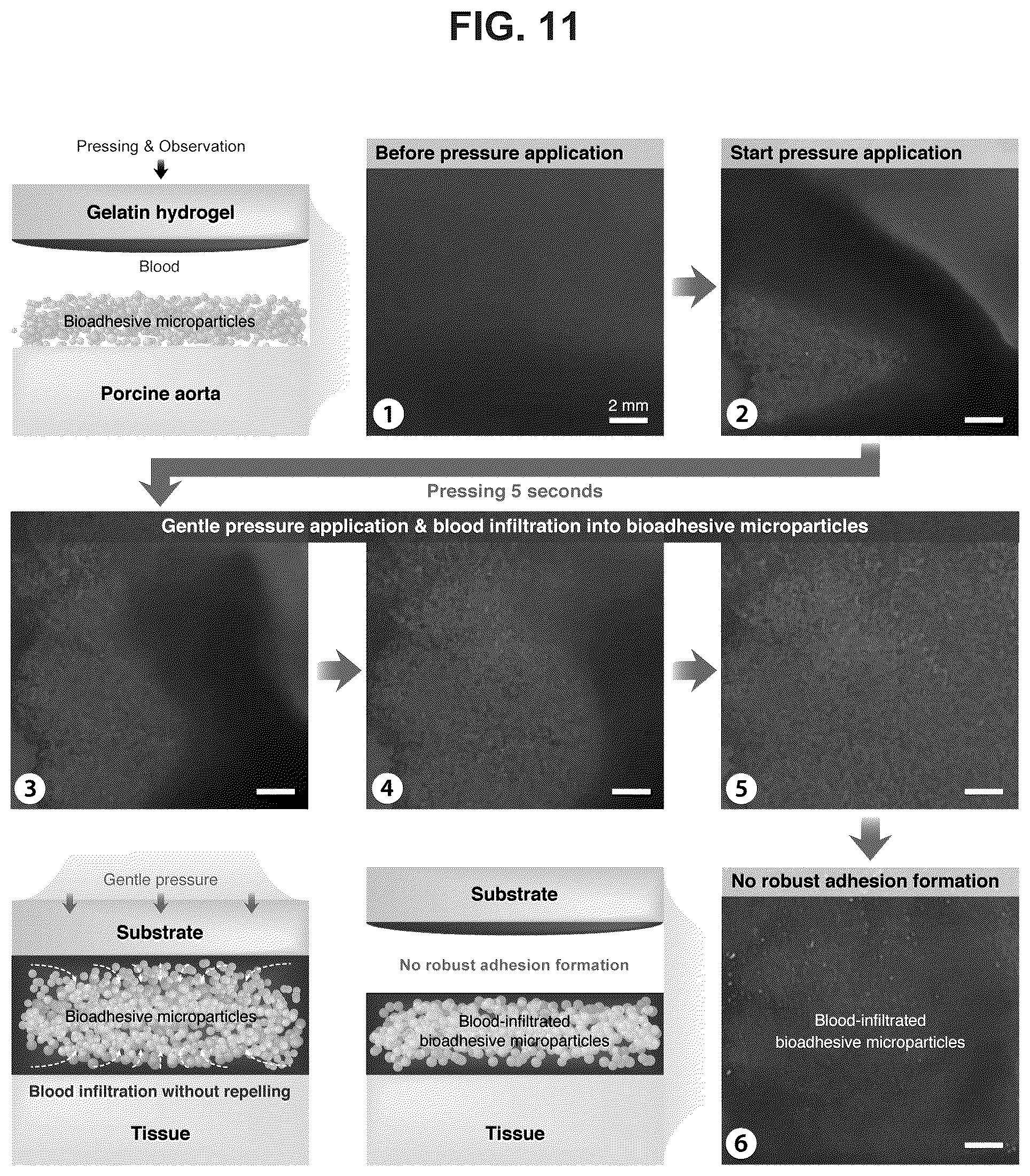 Patent US12319844 Figure 11 – Body fluid resistant tissue adhesives