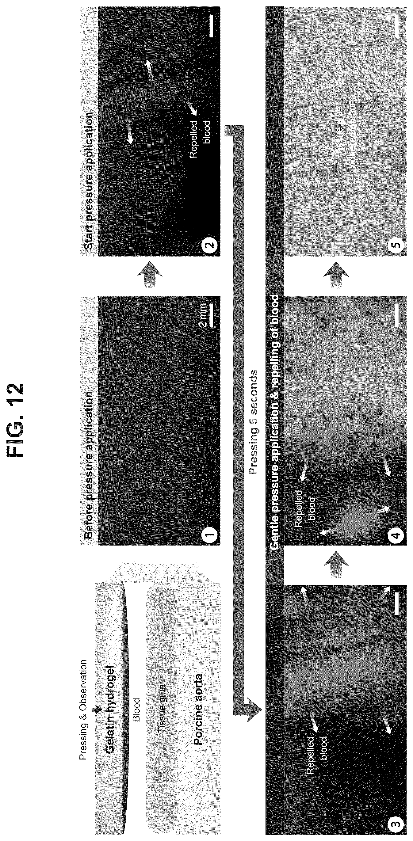 Patent US12319844 Figure 12 – Body fluid resistant tissue adhesives