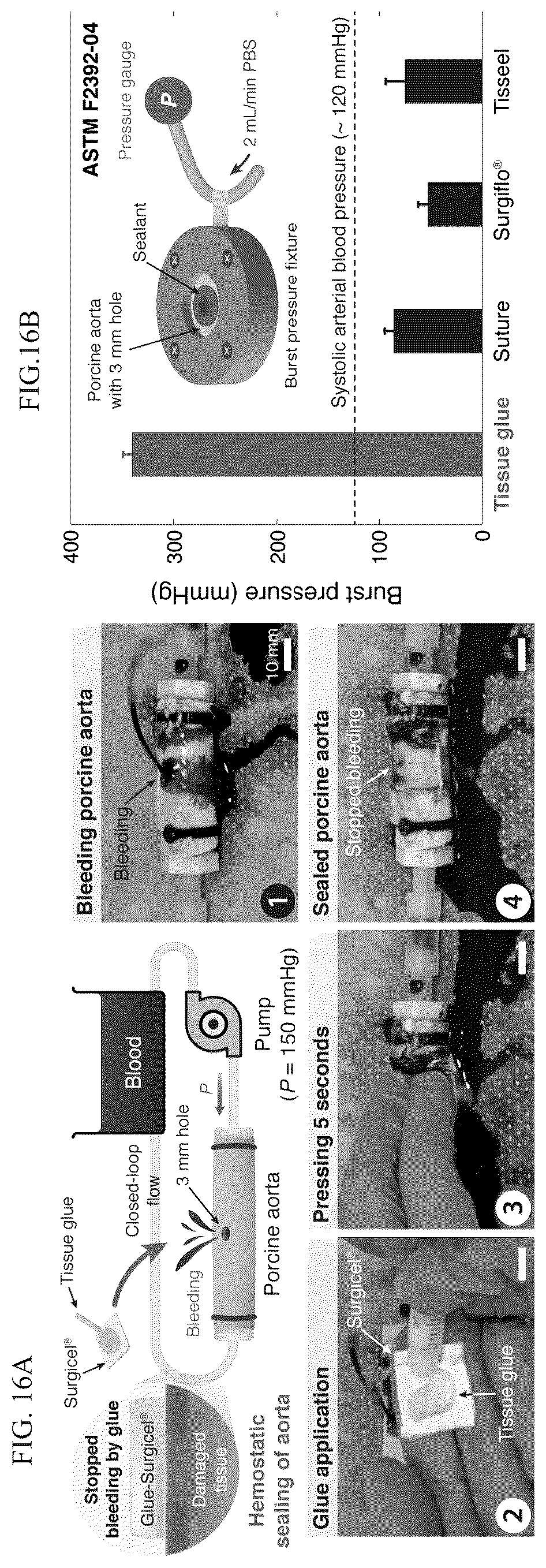 Patent US12319844 Figure 16 – Body fluid resistant tissue adhesives