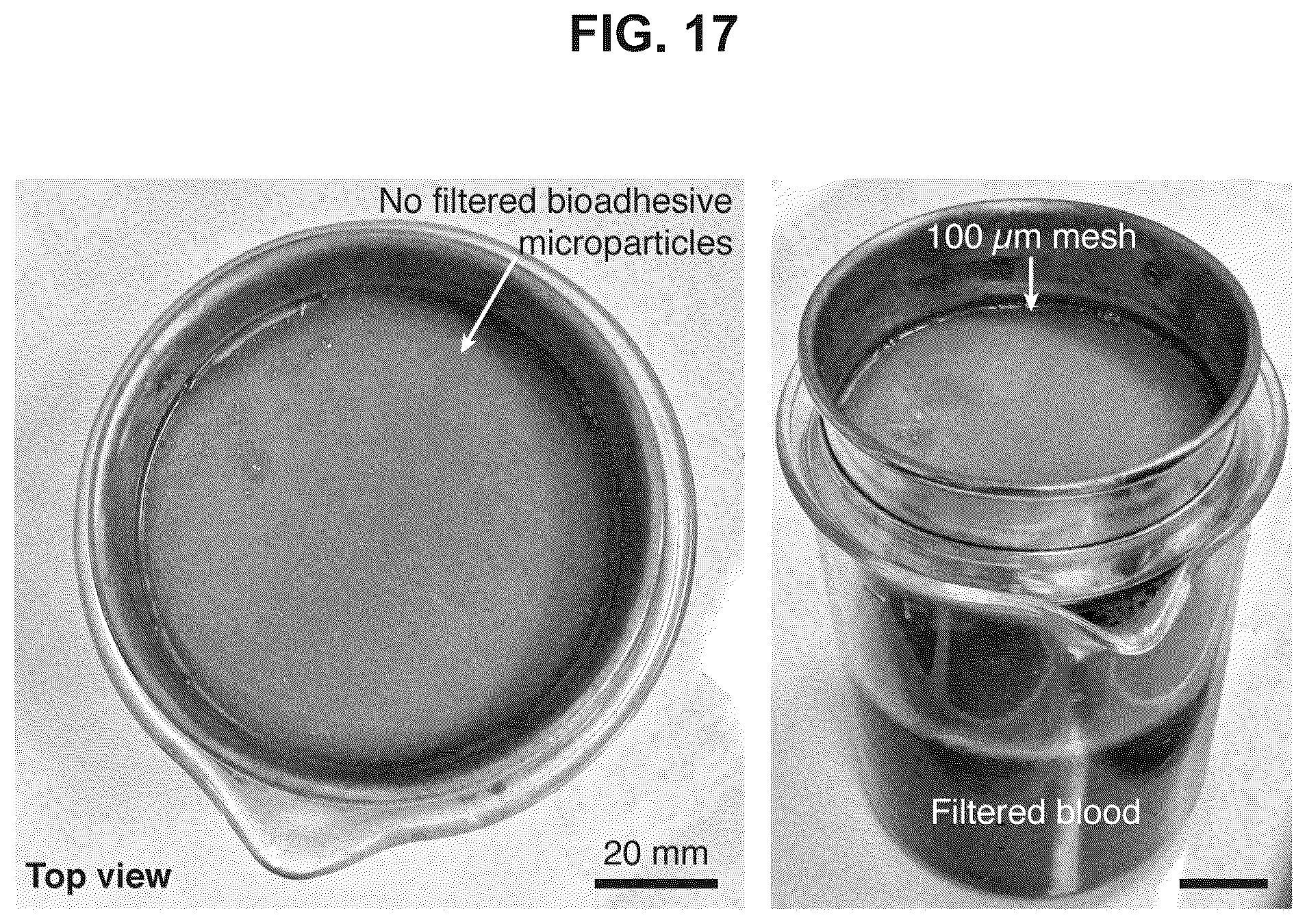 Patent US12319844 Figure 17 – Body fluid resistant tissue adhesives