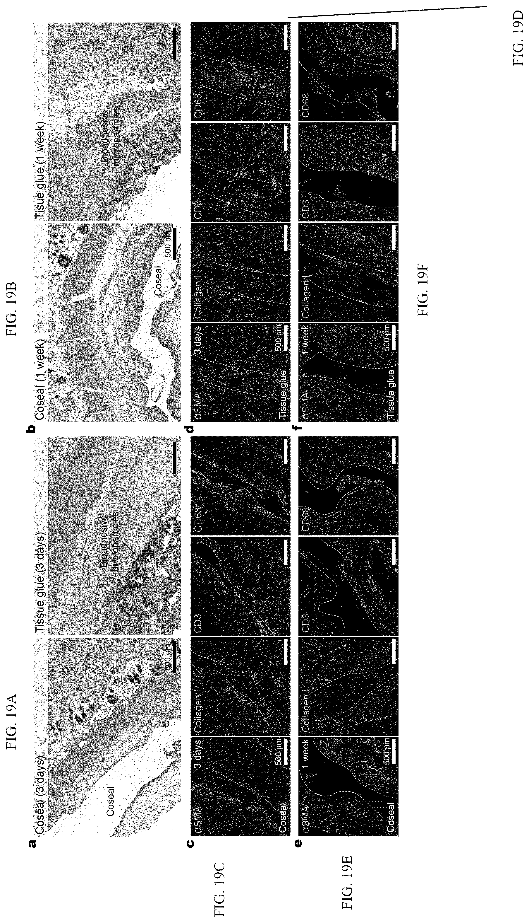 Patent US12319844 Figure 20 – Body fluid resistant tissue adhesives