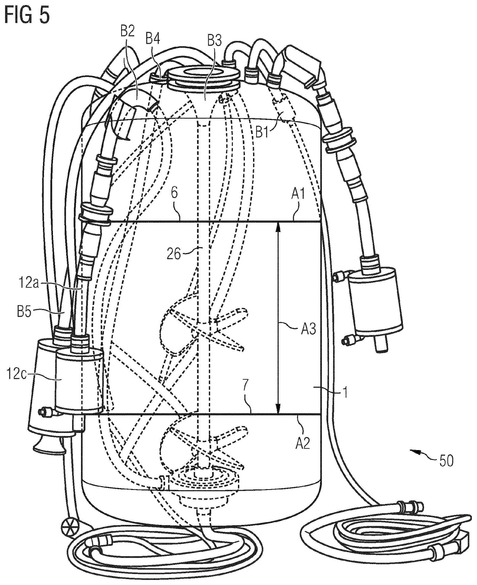 Patent US12319906 Figure 6 – Detecting foam in a bioreactor plant