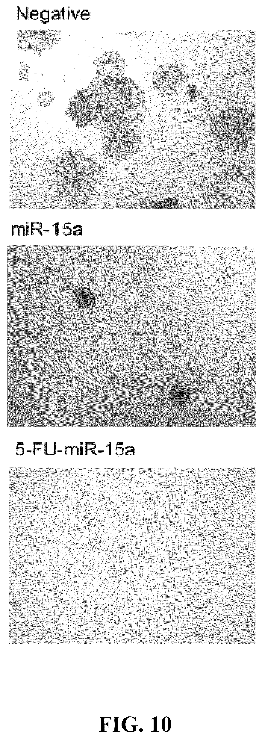 Patent US12319913 Figure 14 – 5-halouracil-modified microRNAs and their use in the treatment of cancer