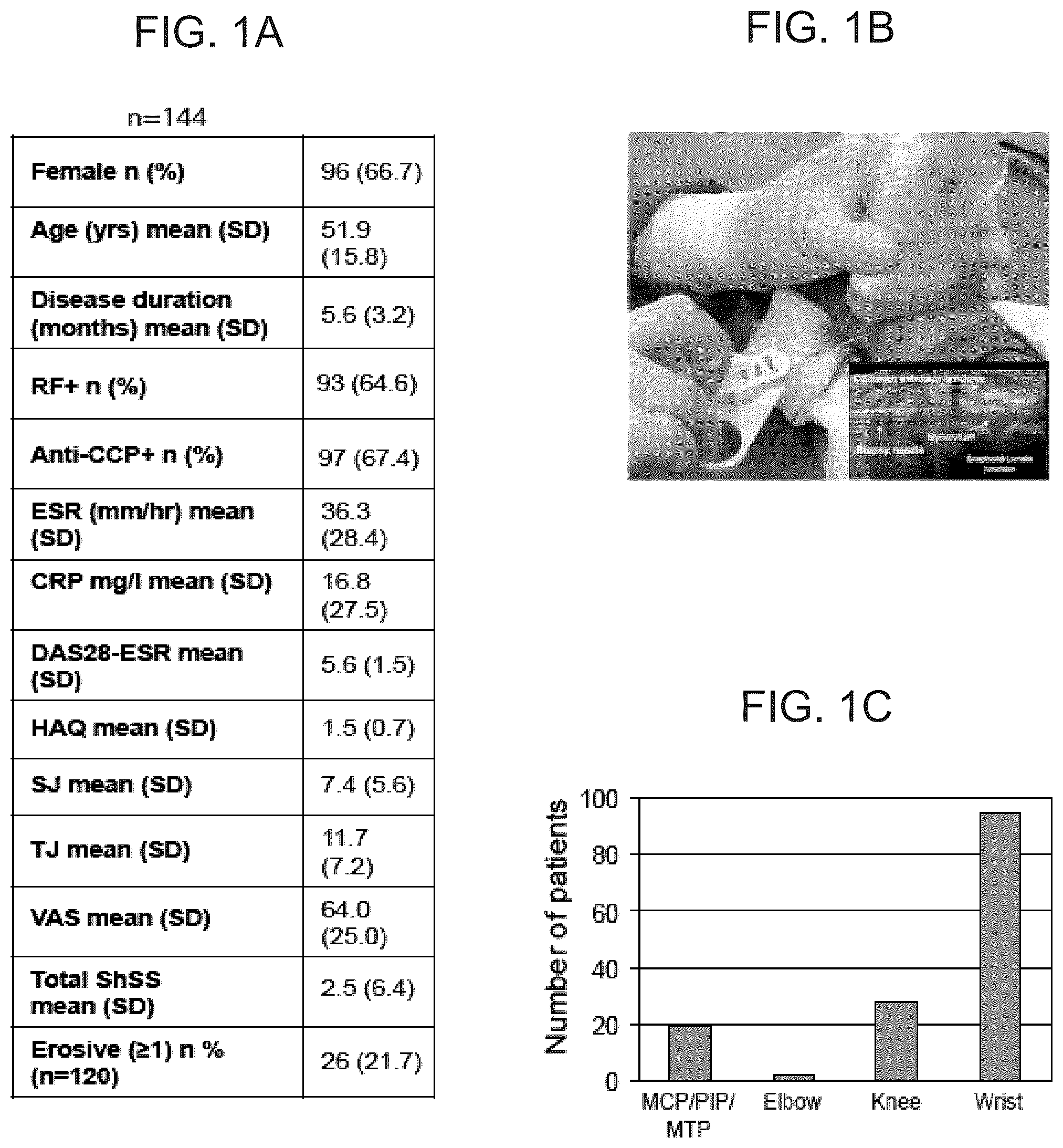 Patent US12319965 Figure 1 – Diagnostic and therapeutic methods for the treatment of rheumatoid arthritis (RA)