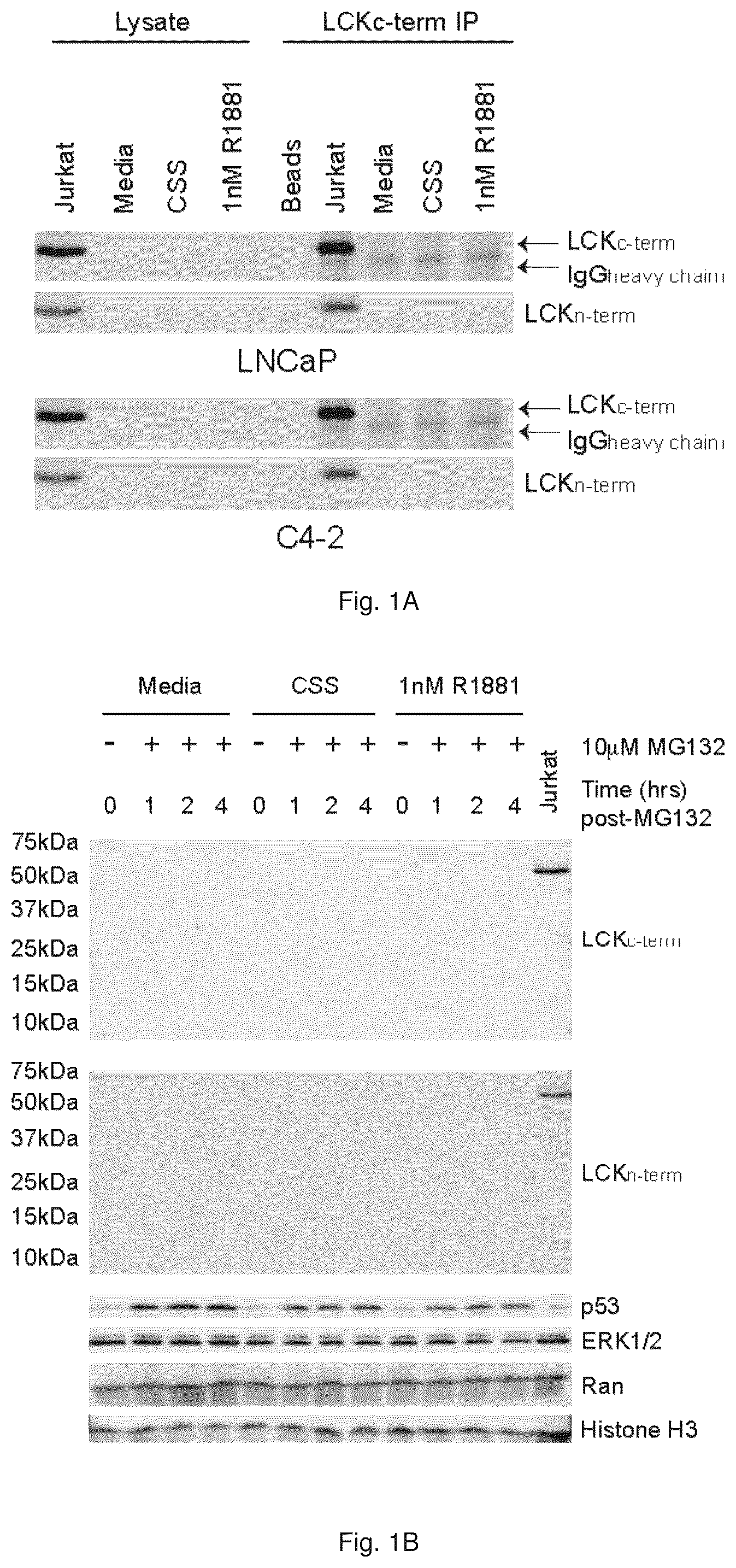 Patent US12319967 Figure 1 – Methods and compositions for diagnosing and treating prostate cancer based on long noncoding RNA overlapping the LCK gene that regulates prostate cancer cell growth
