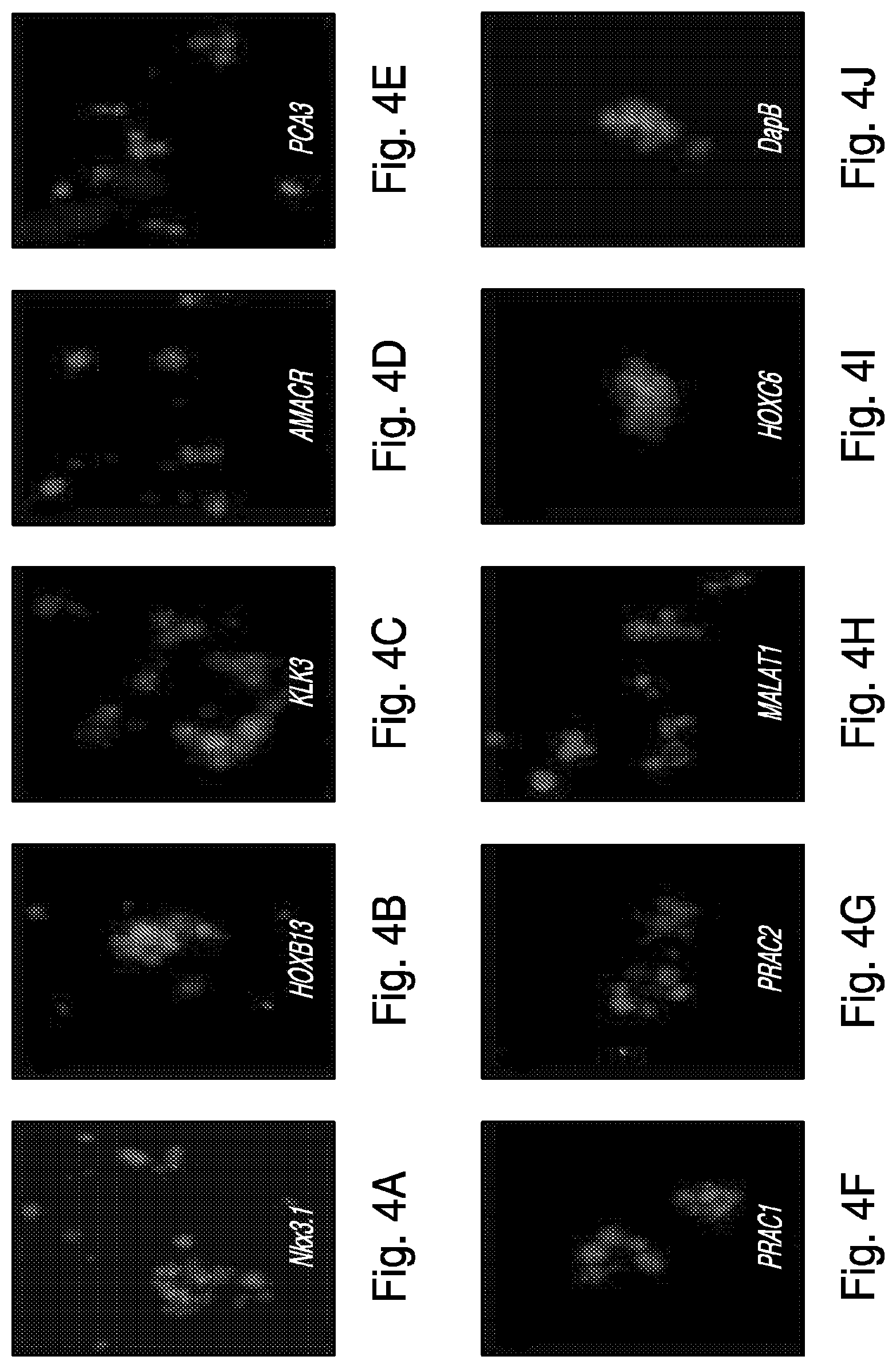 Patent US12319971 Figure 4 – Methods for prostate cancer detection