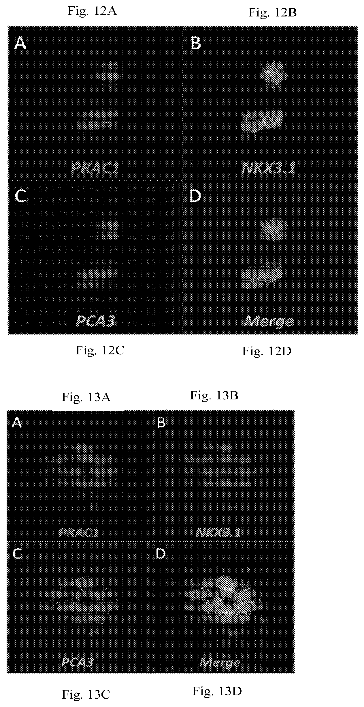 Patent US12319971 Figure 10 – Methods for prostate cancer detection