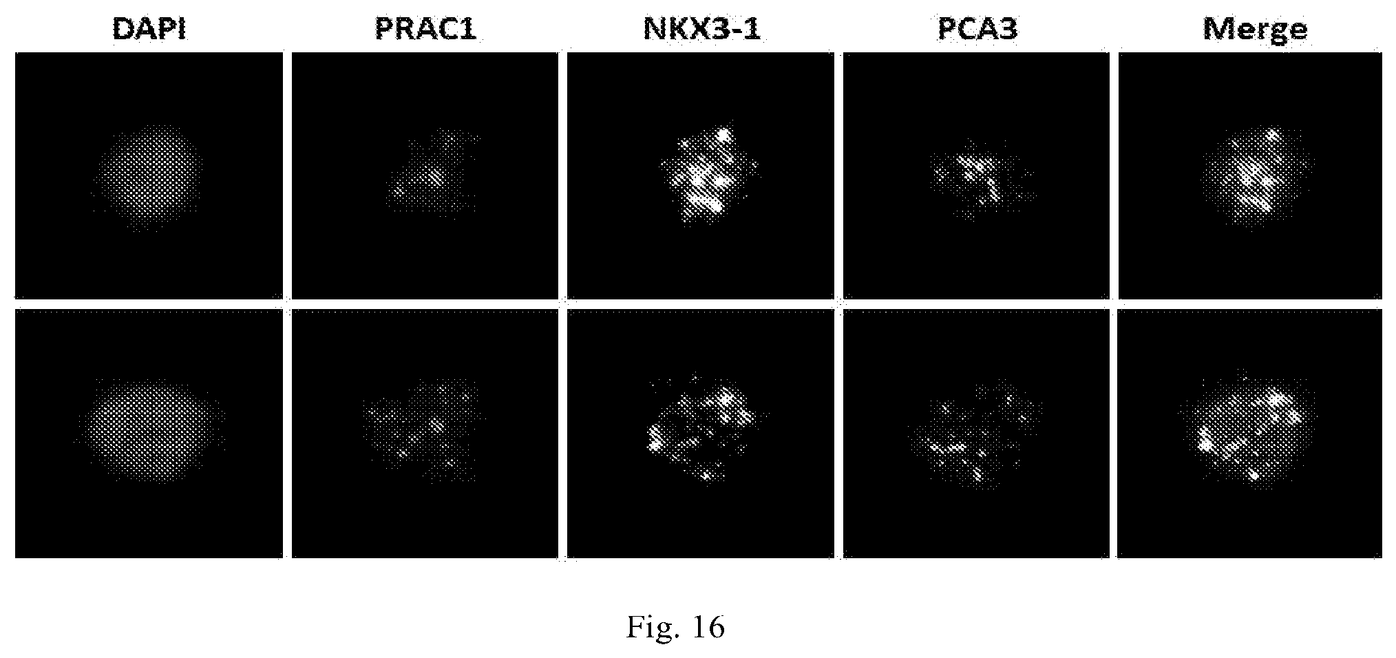 Patent US12319971 Figure 13 – Methods for prostate cancer detection