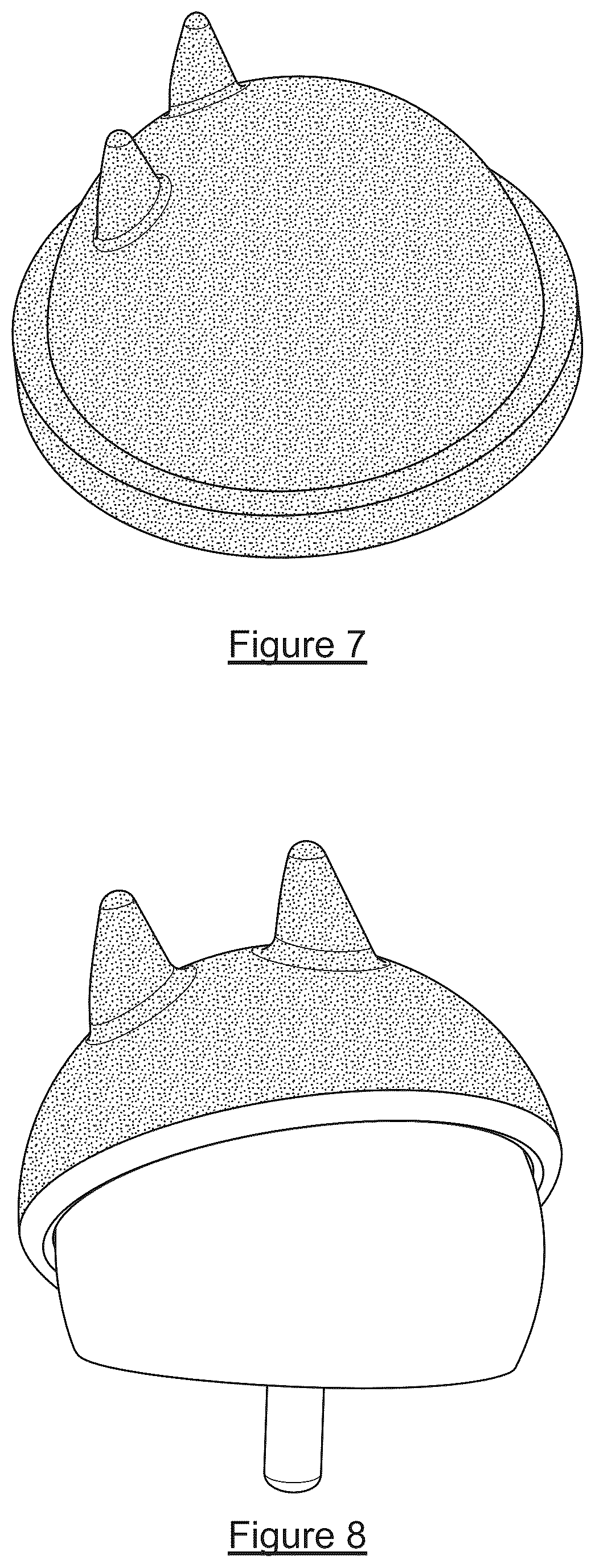 Patent US12320007 Figure 6 – Method for making prosthetic device