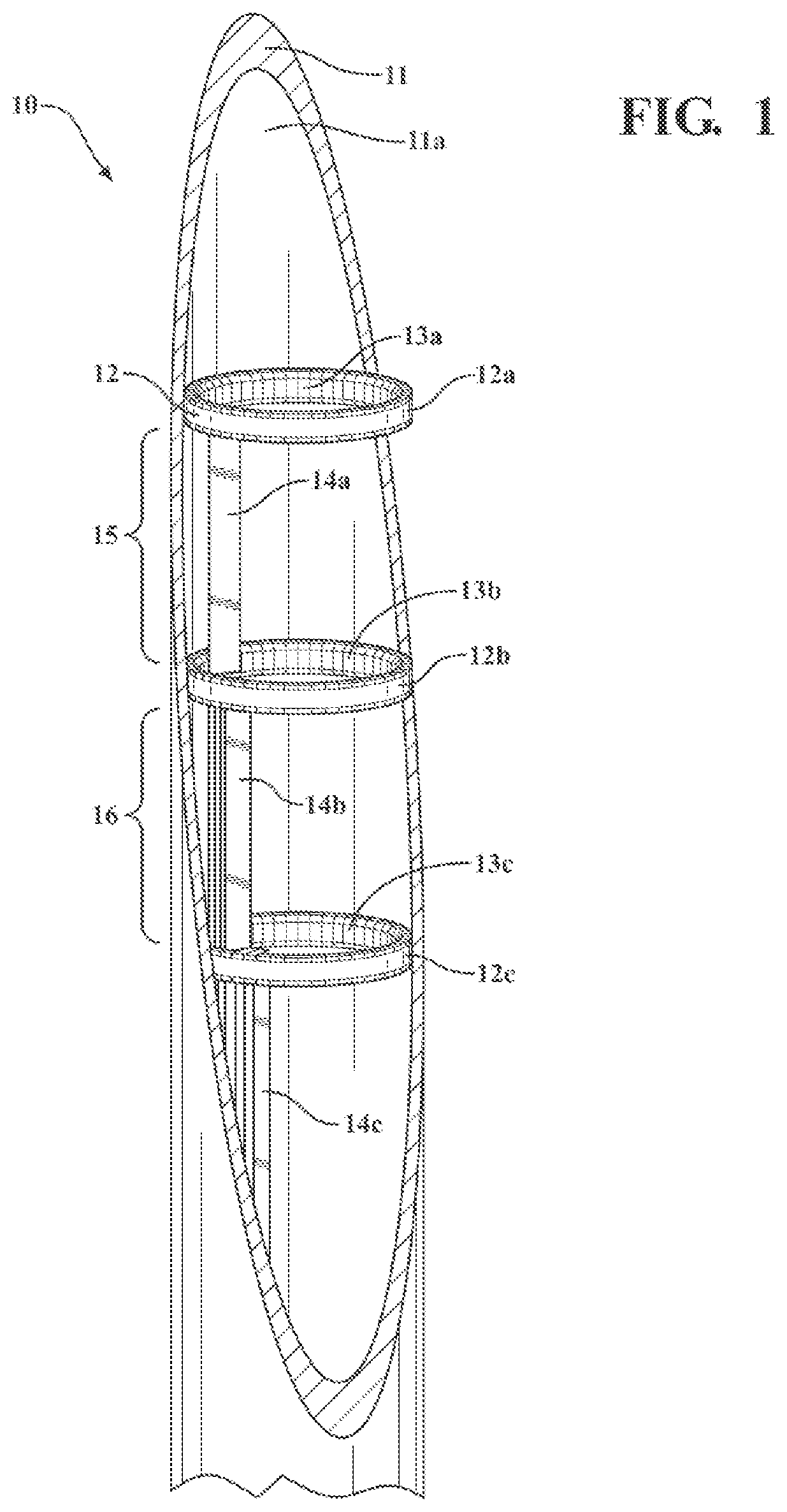 Patent US12320011 — Vitreous coating application by induction heating and integration with induction kinetic weld joining — Figure 1