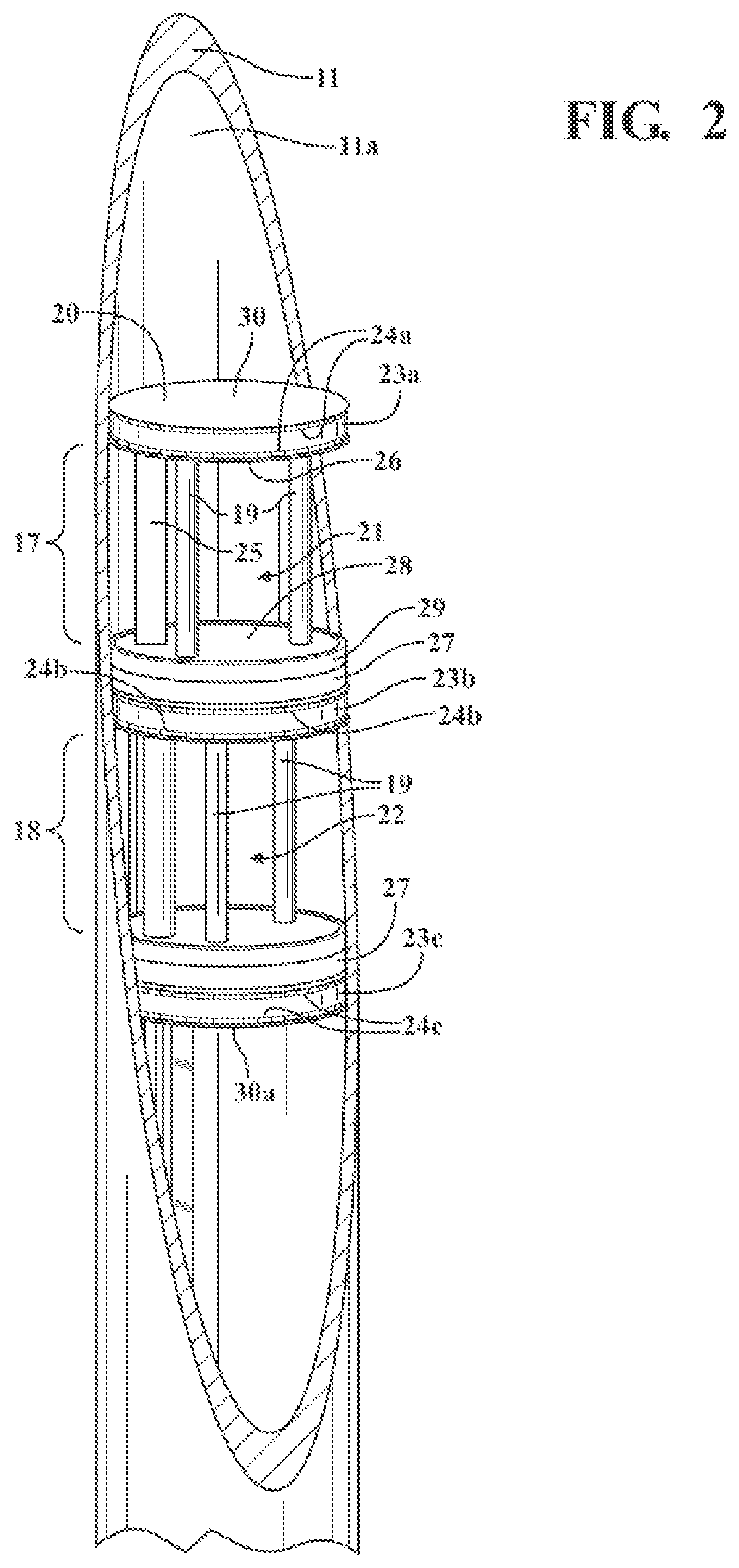 Patent US12320011 Figure 2 – Vitreous coating application by induction heating and integration with induction kinetic weld joining