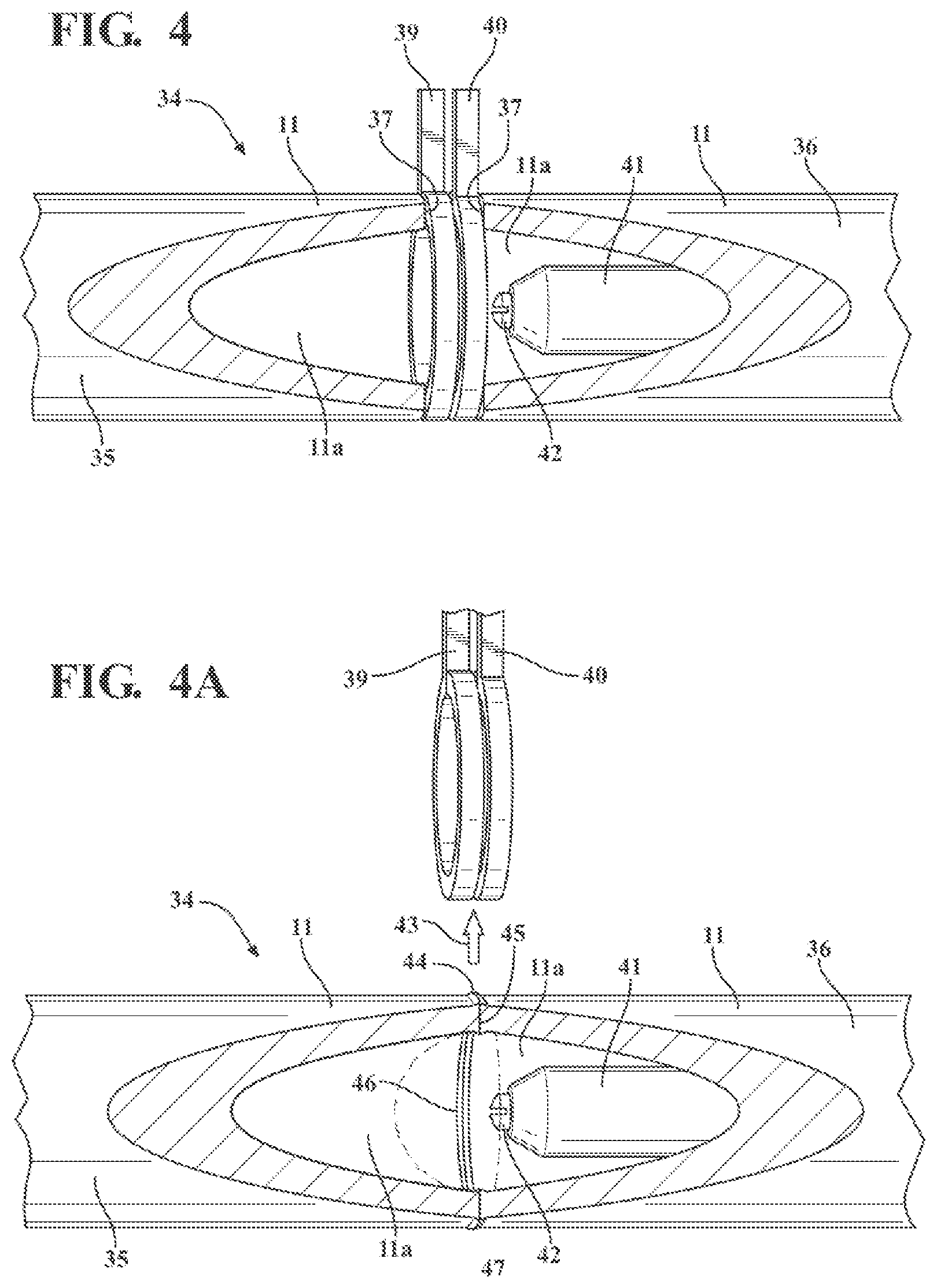 Patent US12320011 Figure 4 – Vitreous coating application by induction heating and integration with induction kinetic weld joining