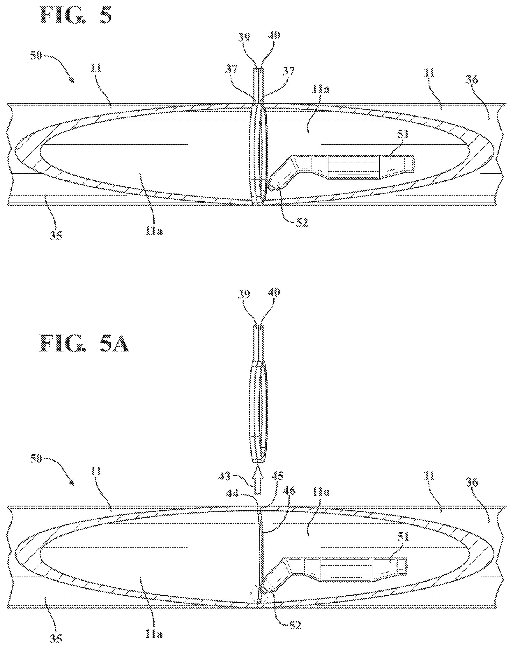 Patent US12320011 Figure 5 – Vitreous coating application by induction heating and integration with induction kinetic weld joining