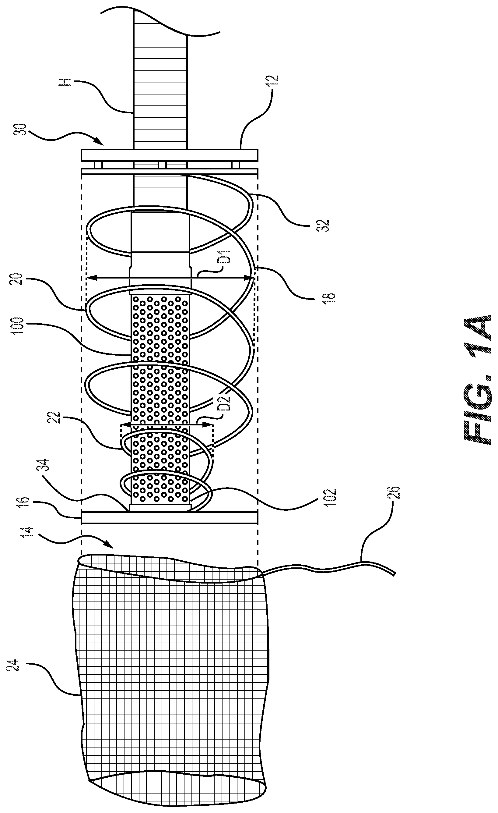 Patent US12320087 Figure 1 – Submerged liquid intake strainers