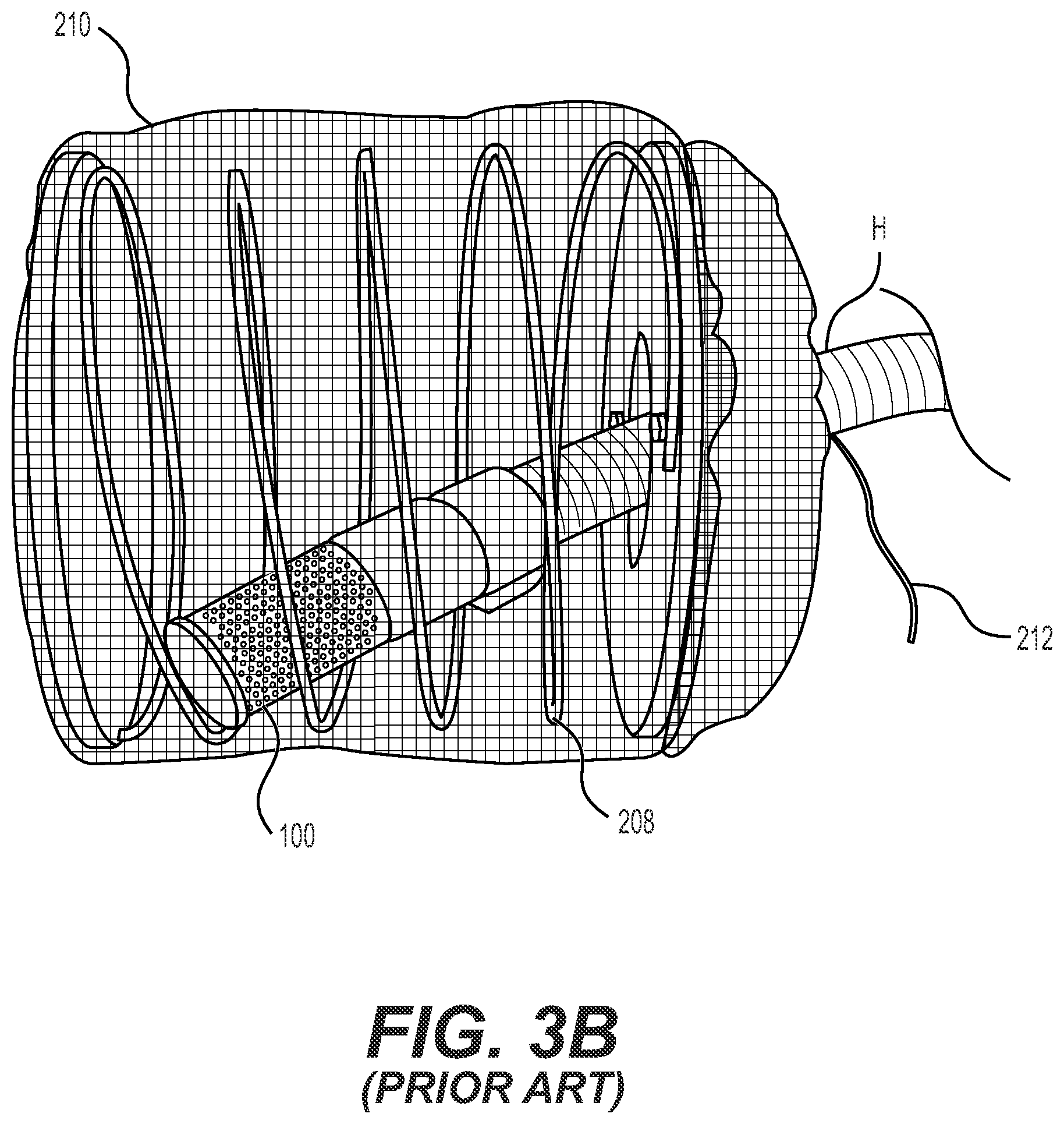 Patent US12320087 Figure 5 – Submerged liquid intake strainers