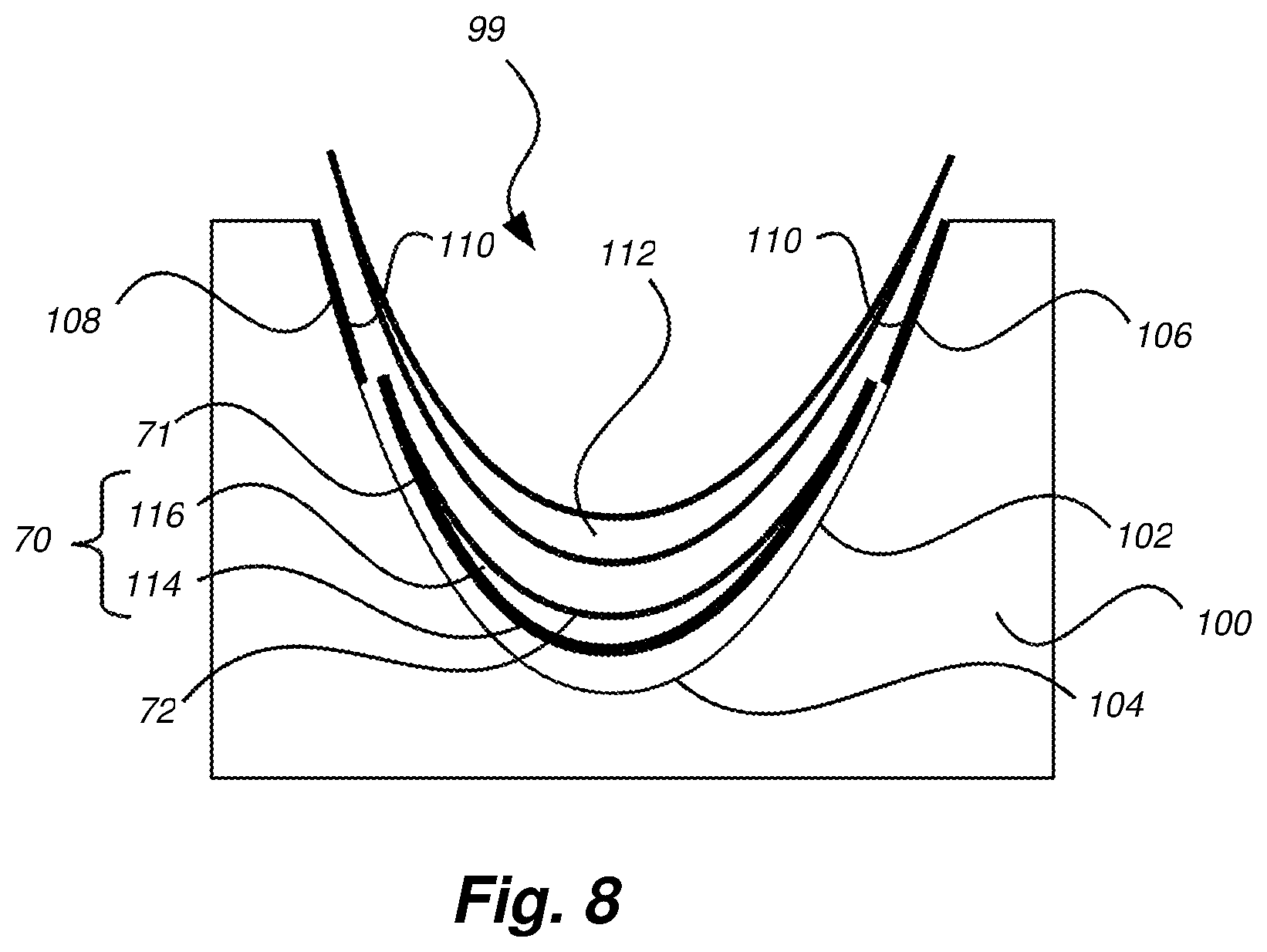 Patent US12320329 Figure 5 – Wind turbine rotor blade with a leading edge member