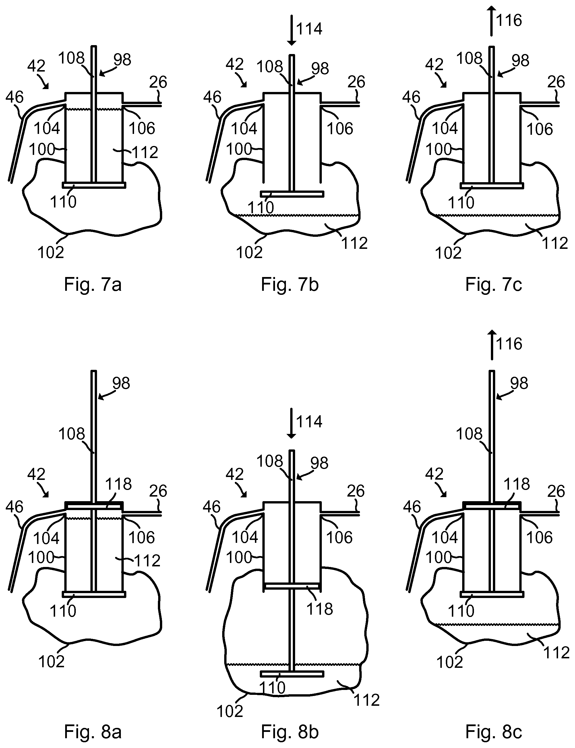 Patent US12320343 Figure 5 – Arrangements and methods for avoiding spreading of infectious agents and improving electric safety and suction performance of a medical aspirator