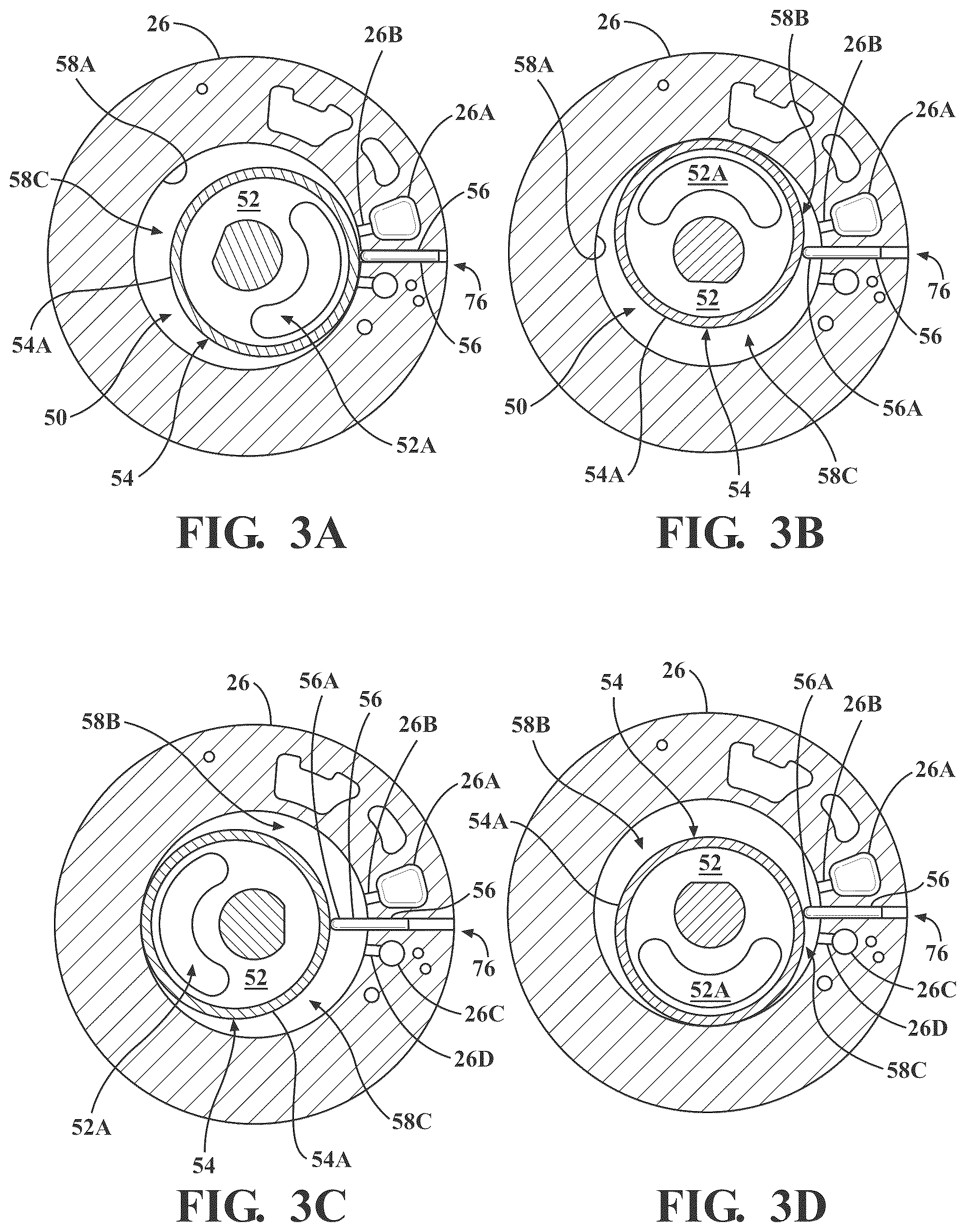 Patent US12320354 Figure 4 – Compression device having integrated discharge chamber(s) and compressor with compression device having integrated discharge chamber(s)