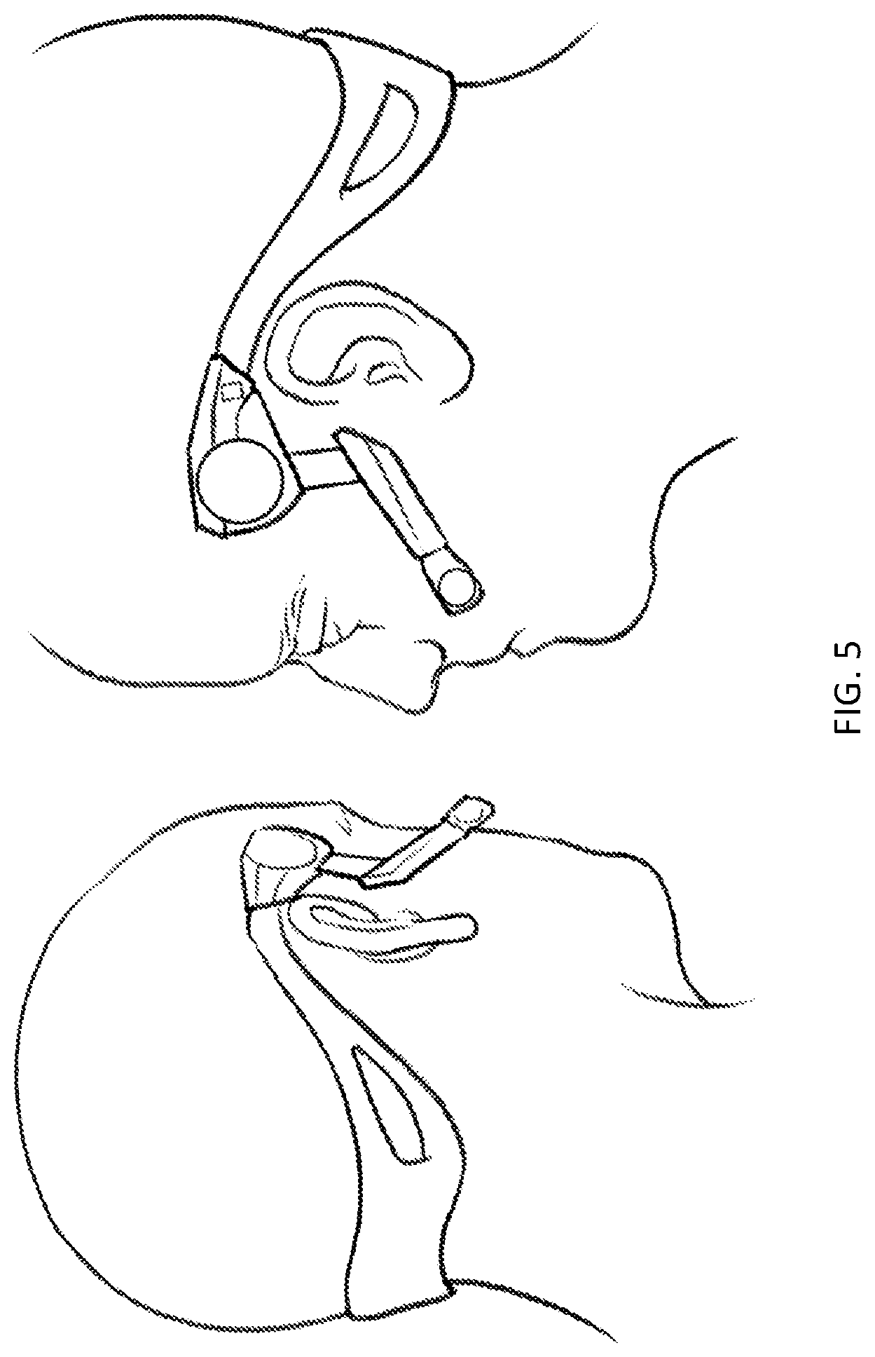 Patent US12320504 Figure 7 – Head-mounted illumination devices
