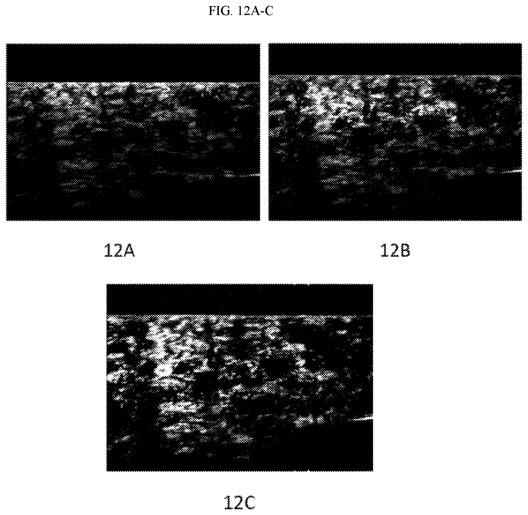 Patent US12320640 Figure 14 – Optical system and interference objective module therof