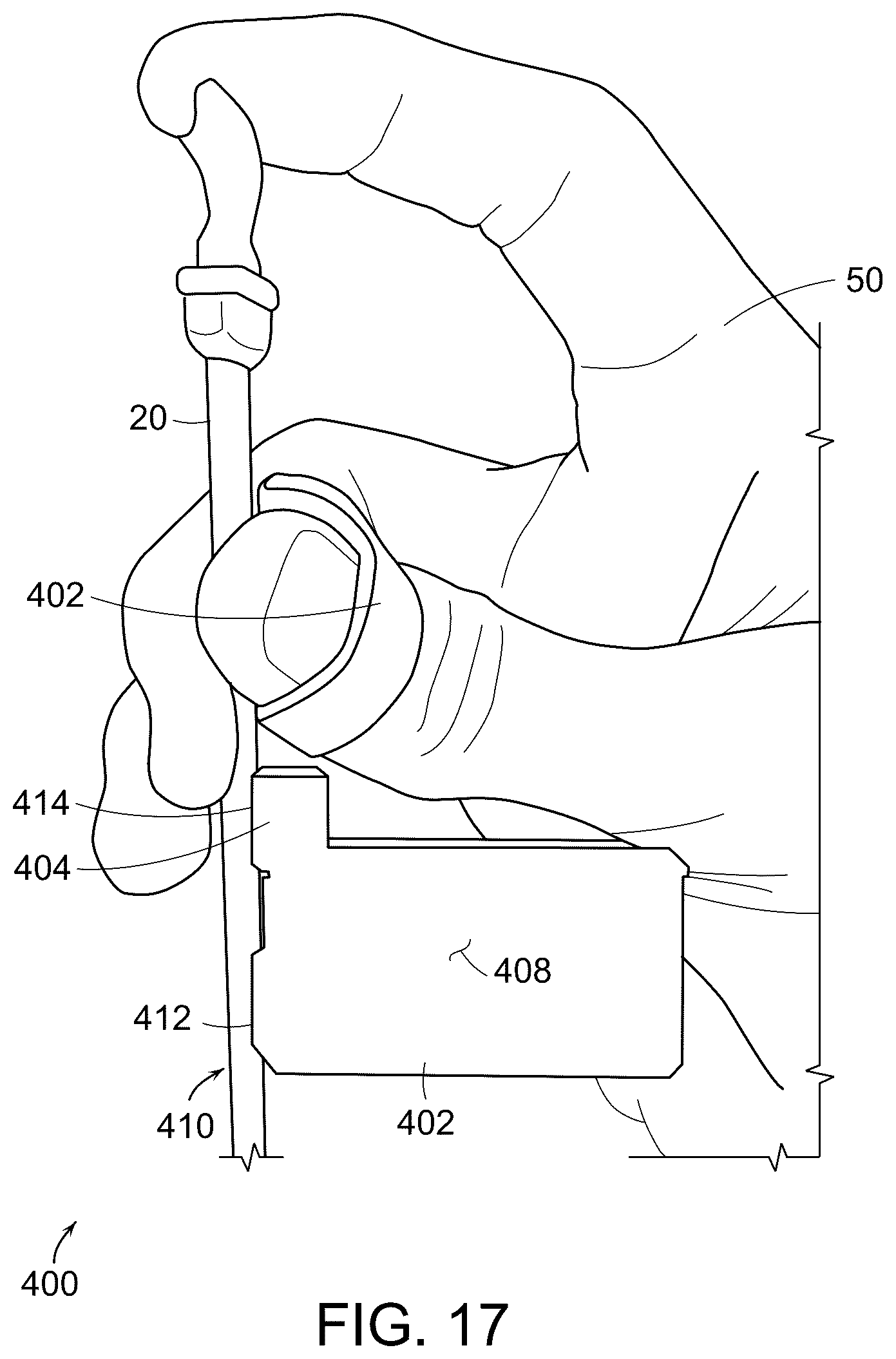 Patent US12320646 Figure 17 – Systems, method and devices for assisting or performing guiding interventional procedures using inertial measurement units and magnetometer sensors