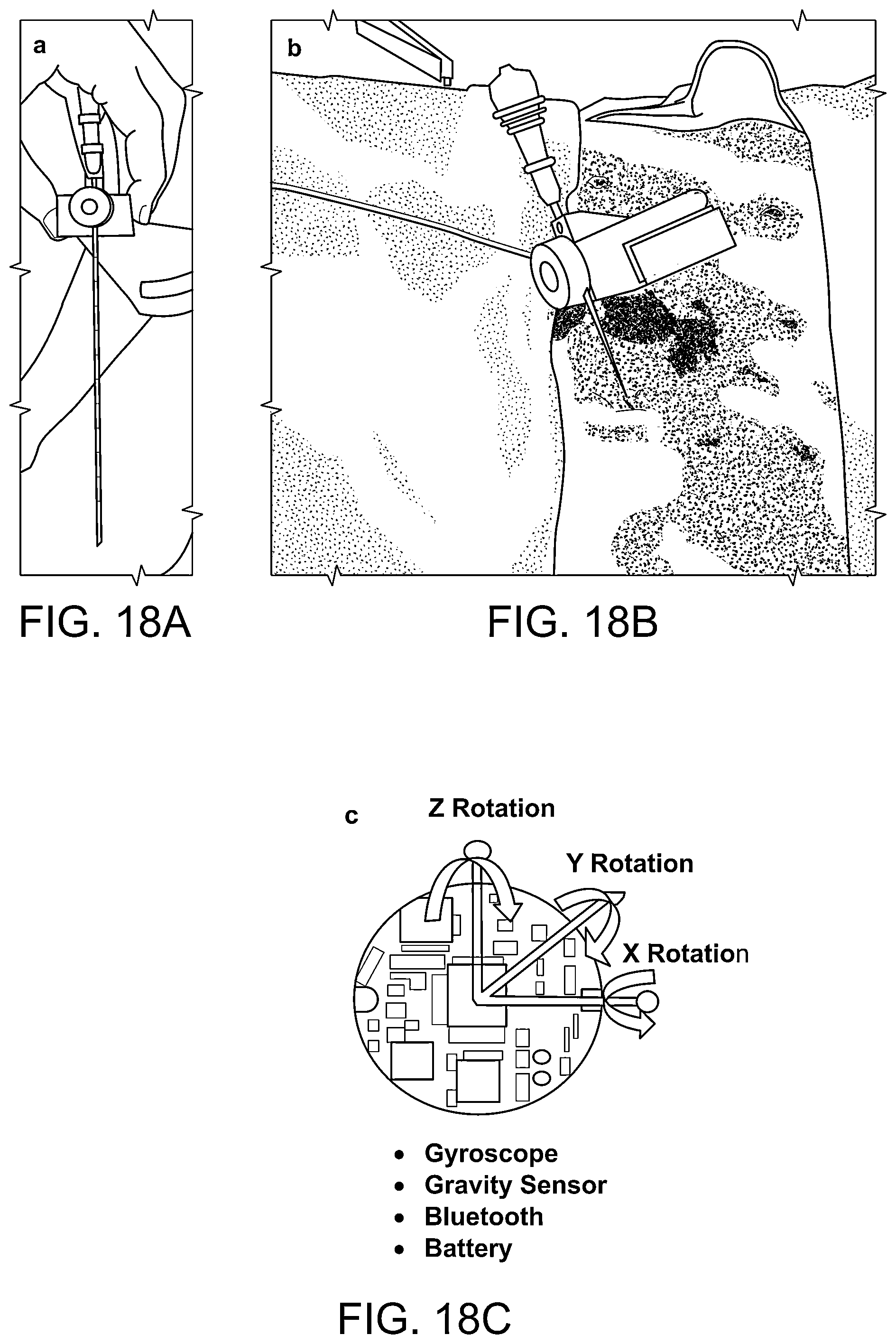 Patent US12320646 Figure 18 – Systems, method and devices for assisting or performing guiding interventional procedures using inertial measurement units and magnetometer sensors